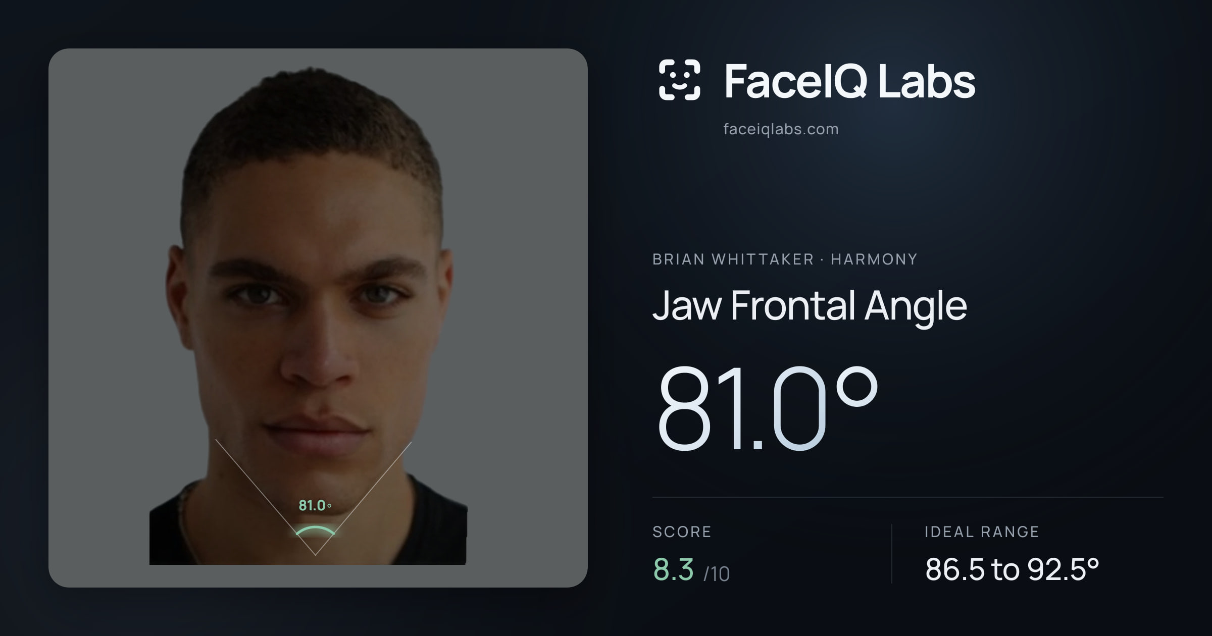 Brian Whittaker Jaw Frontal Angle: 81.0°, drawn on the photo