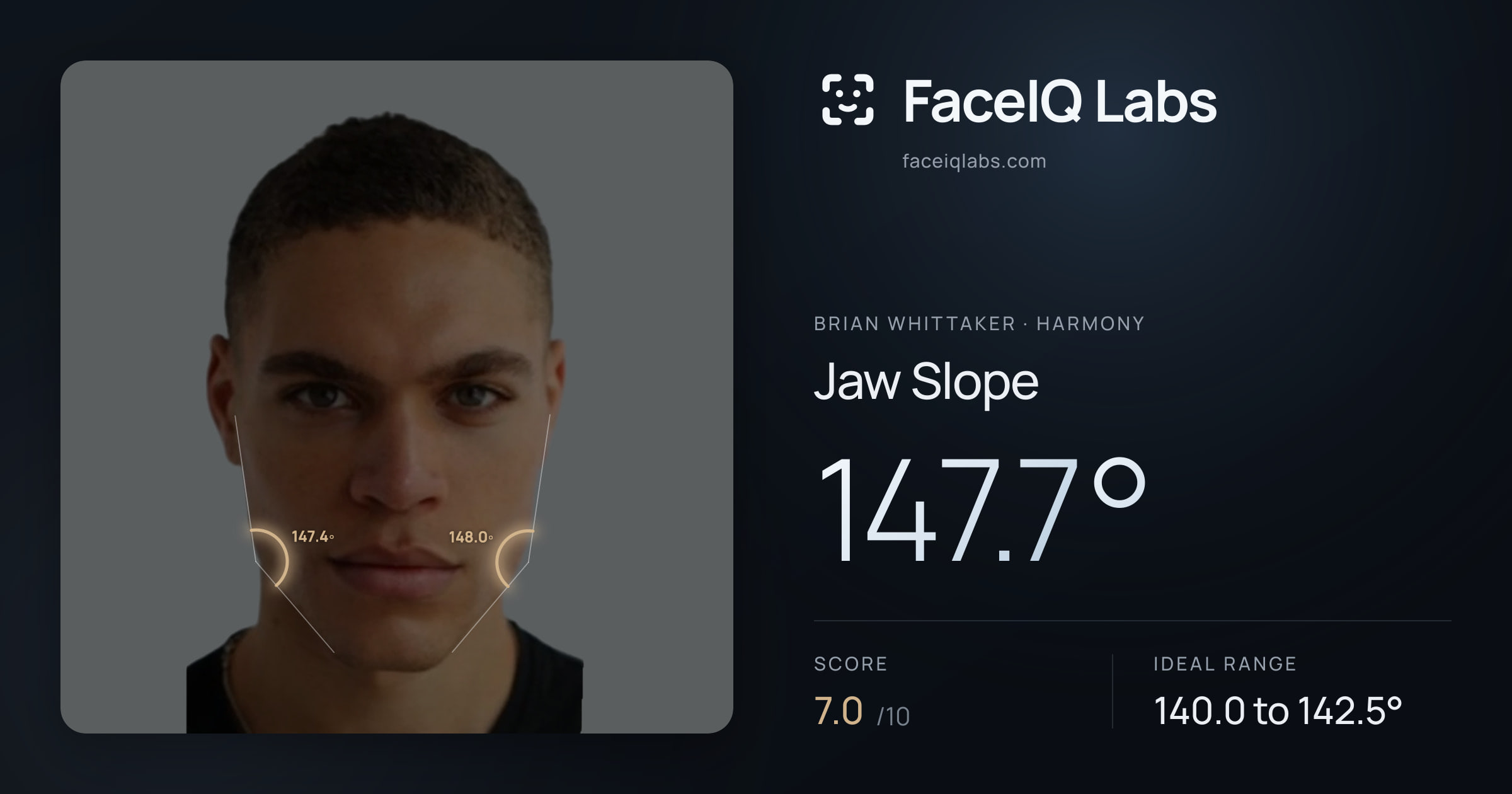 Brian Whittaker Jaw Slope: 147.7°, drawn on the photo