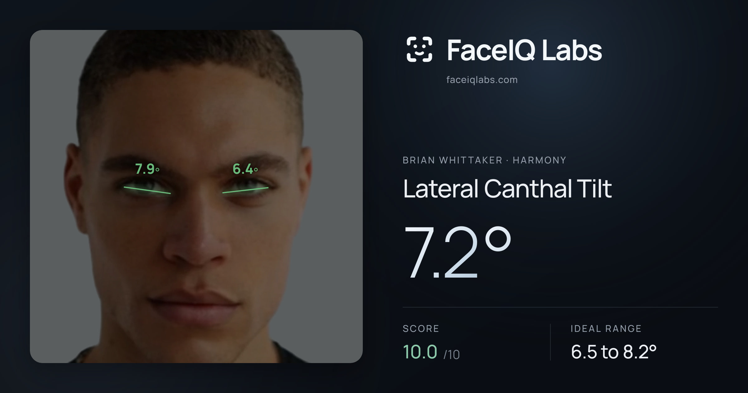 Brian Whittaker Lateral Canthal Tilt: 7.2°, drawn on the photo