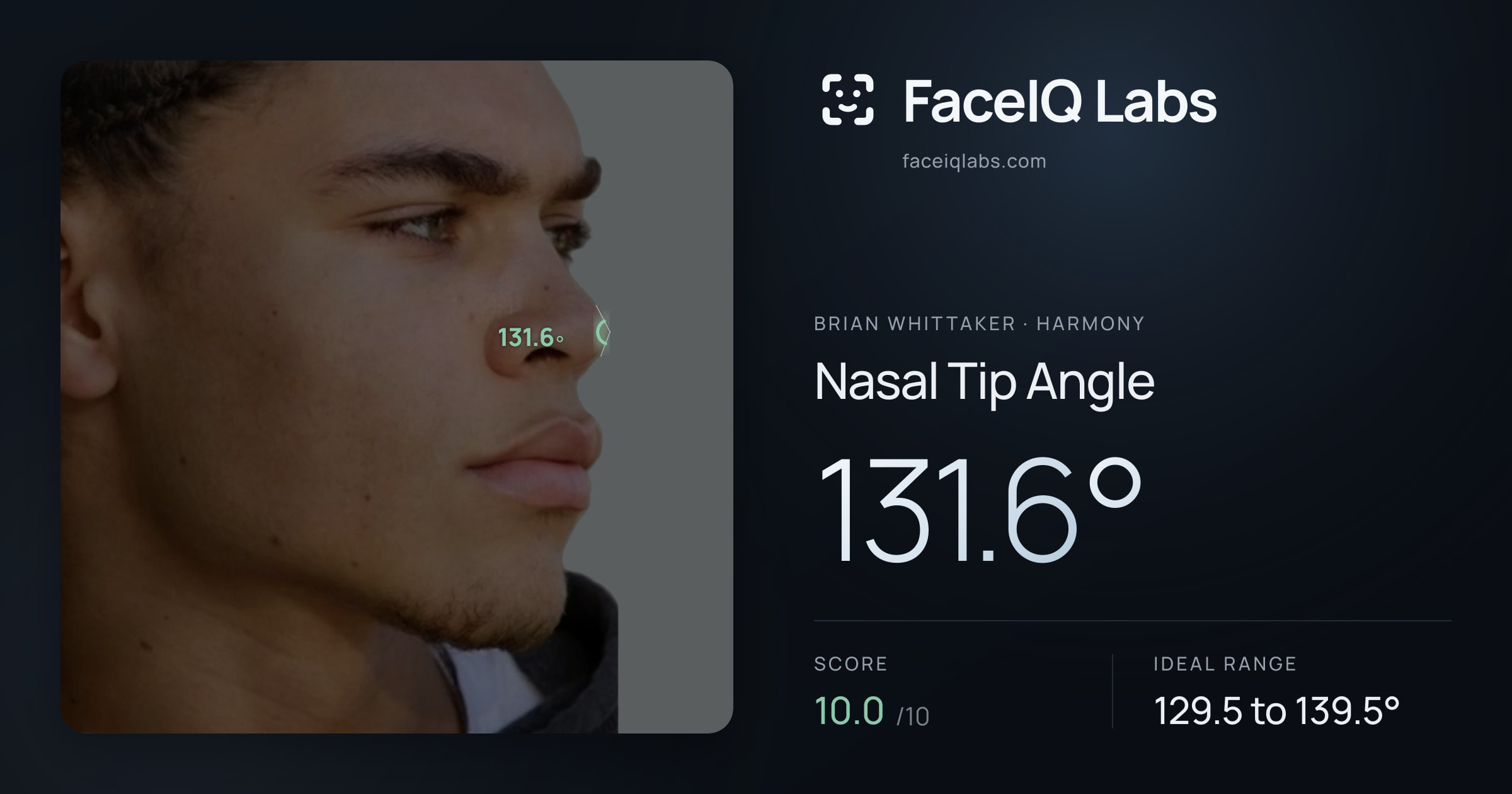 Brian Whittaker Nasal Tip Angle: 131.6°, drawn on the photo