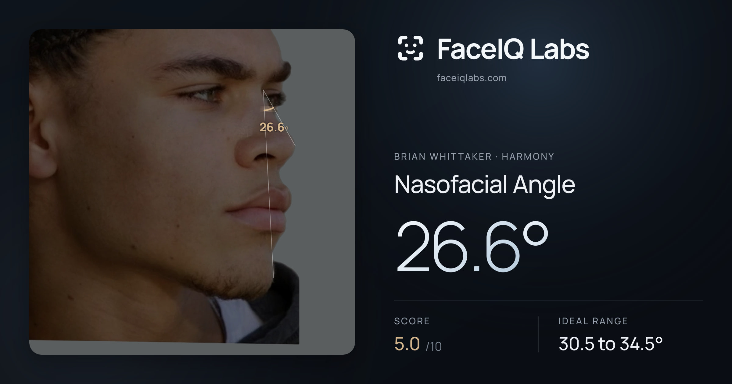 Brian Whittaker Nasofacial Angle: 26.6°, drawn on the photo