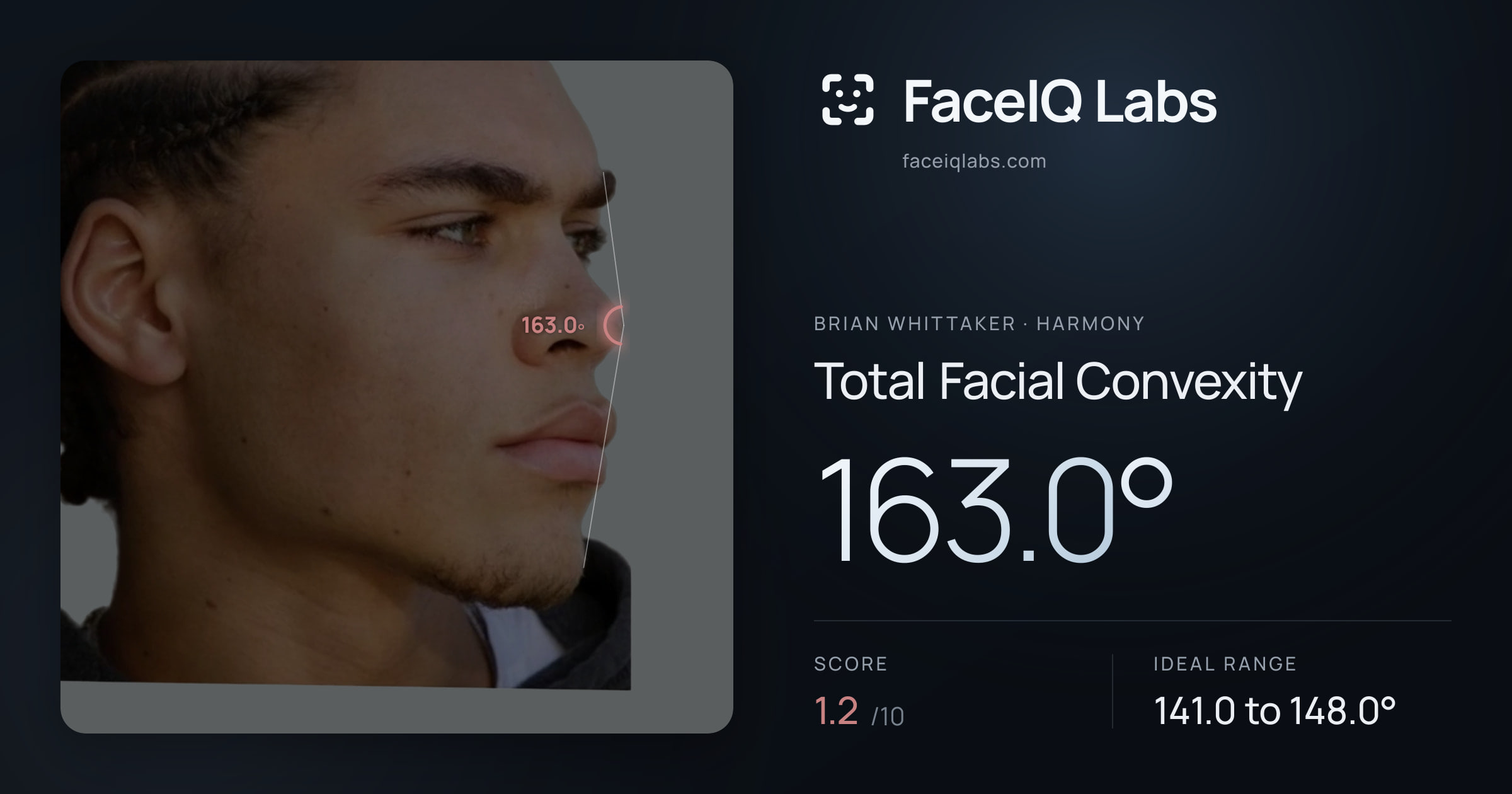 Brian Whittaker Total Facial Convexity: 163.0°, drawn on the photo