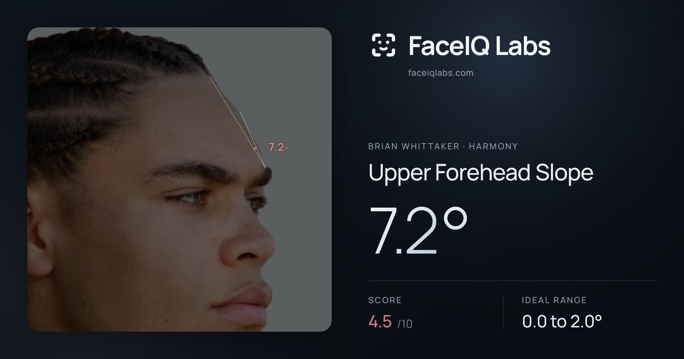 Brian Whittaker Upper Forehead Slope: 7.2°, drawn on the photo