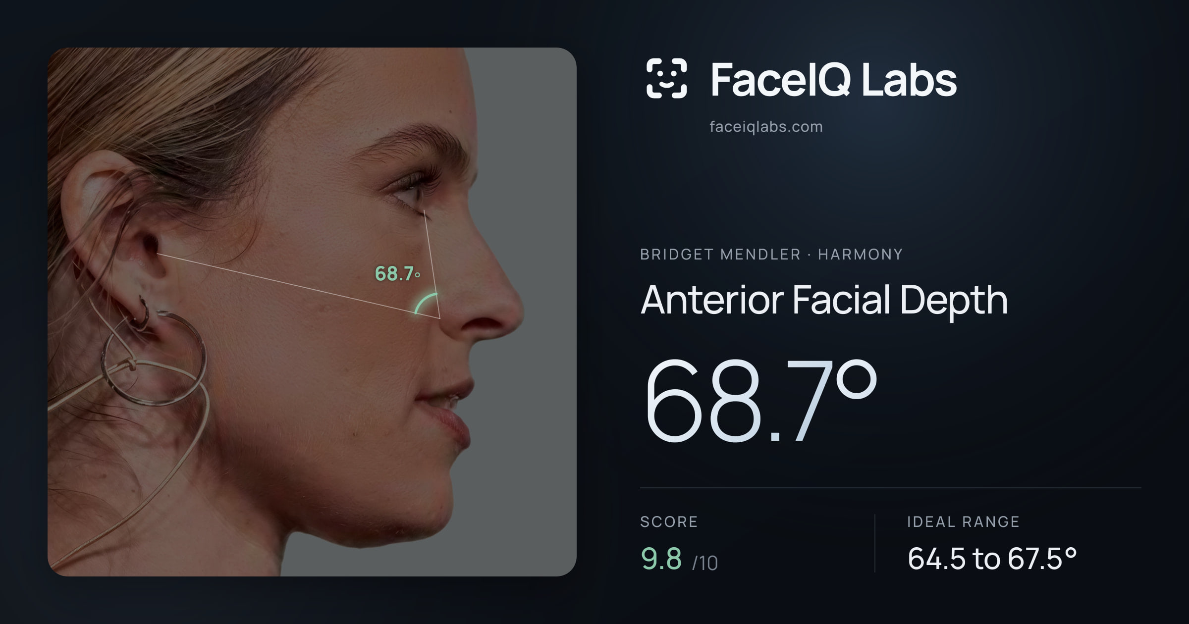 Bridget Mendler Anterior Facial Depth: 68.7°, drawn on the photo