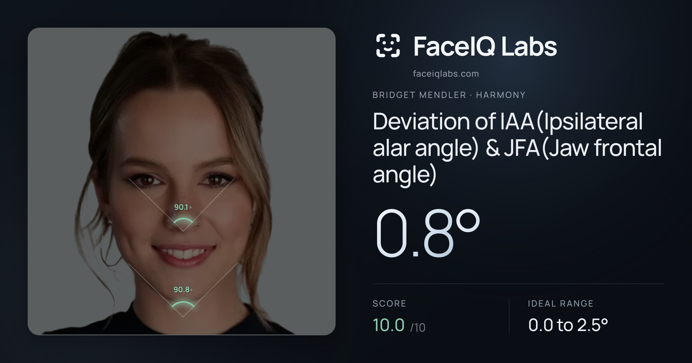Bridget Mendler Deviation of IAA(Ipsilateral alar angle) & JFA(Jaw frontal angle): 0.8°, drawn on the photo