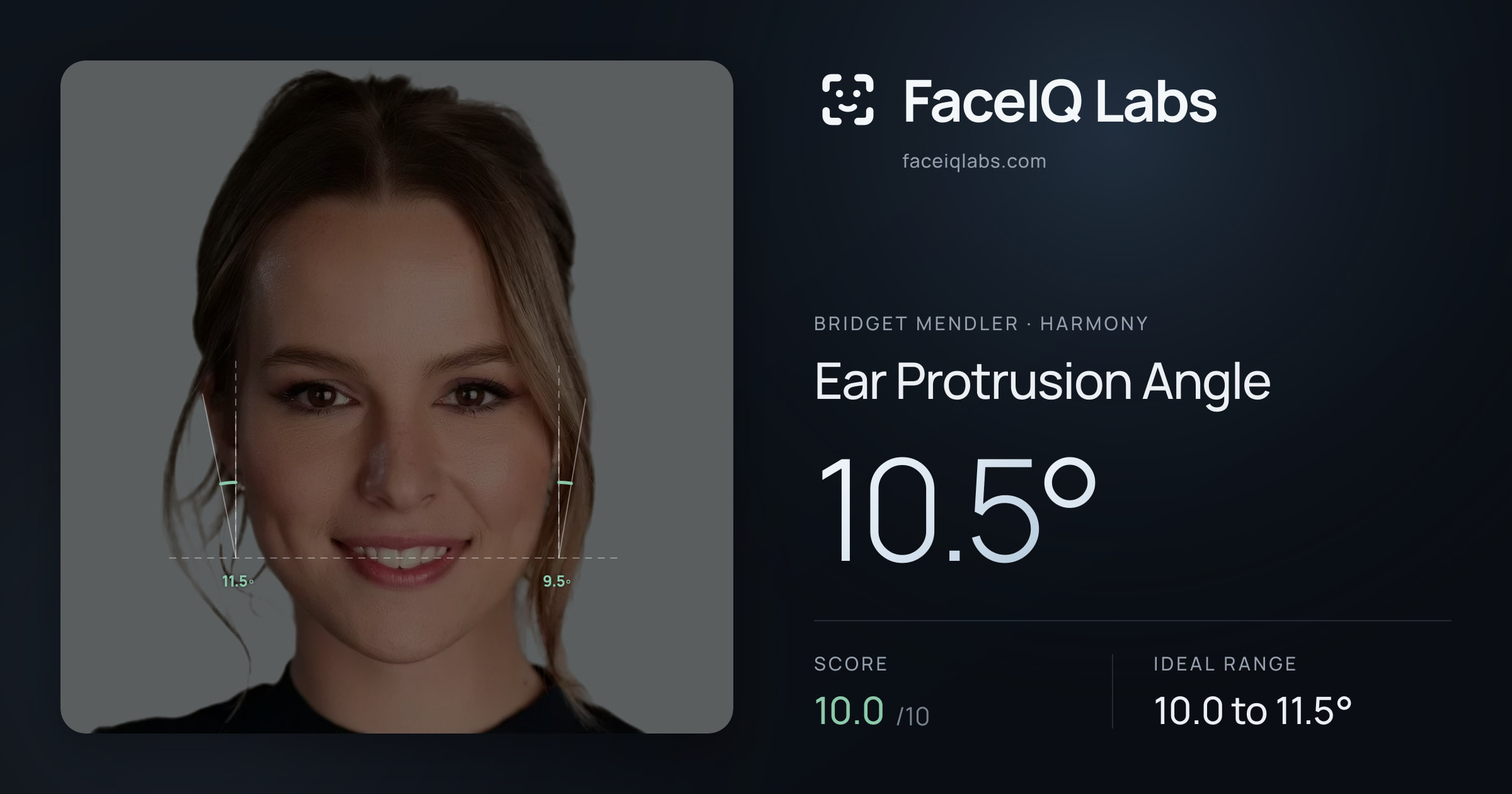Bridget Mendler Ear Protrusion Angle: 10.5°, drawn on the photo