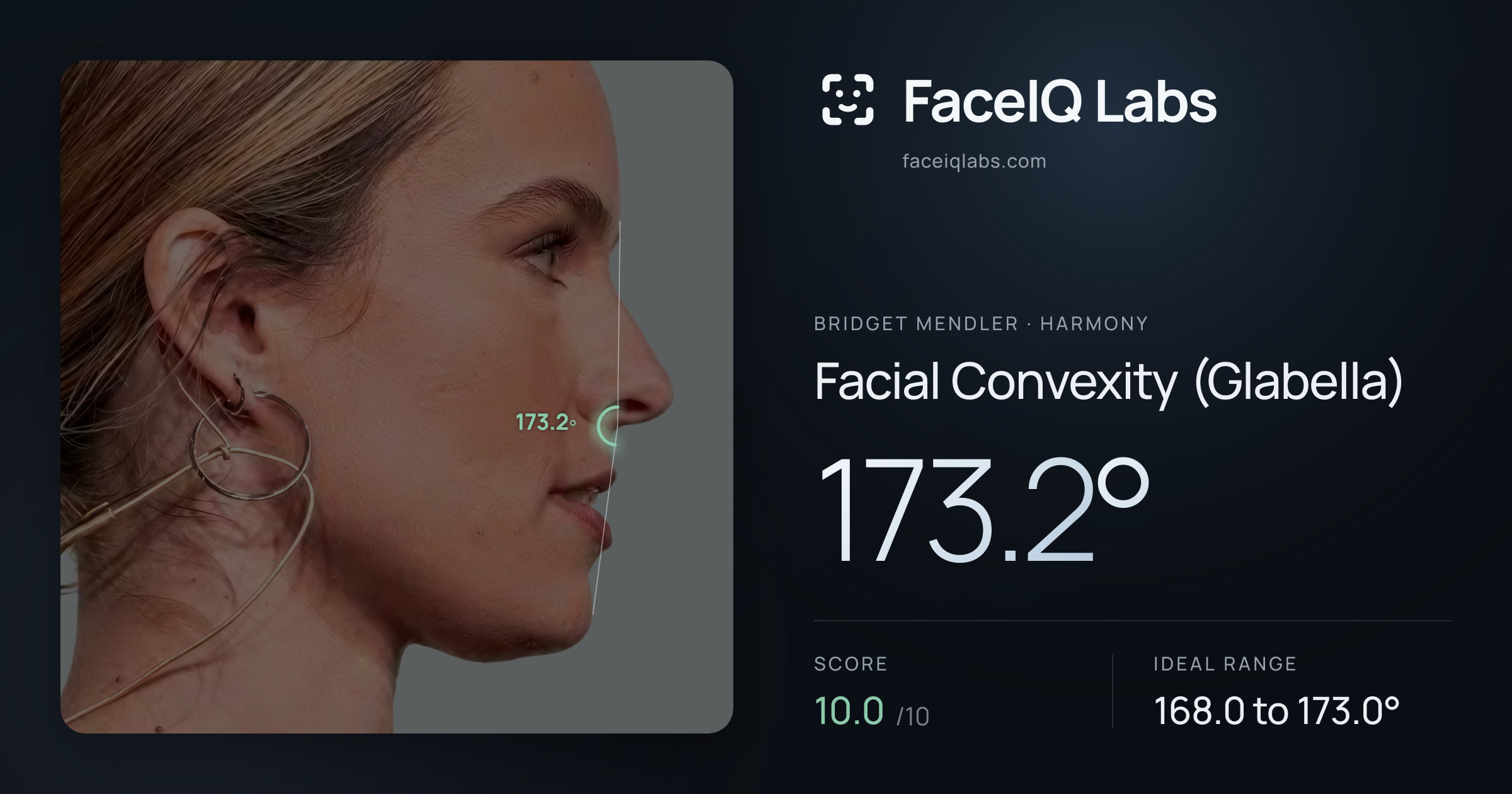 Bridget Mendler Facial Convexity (Glabella): 173.2°, drawn on the photo