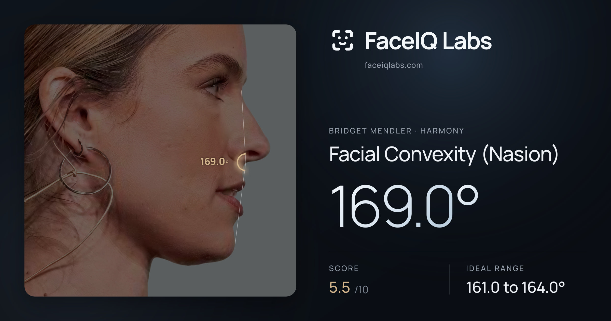 Bridget Mendler Facial Convexity (Nasion): 169.0°, drawn on the photo