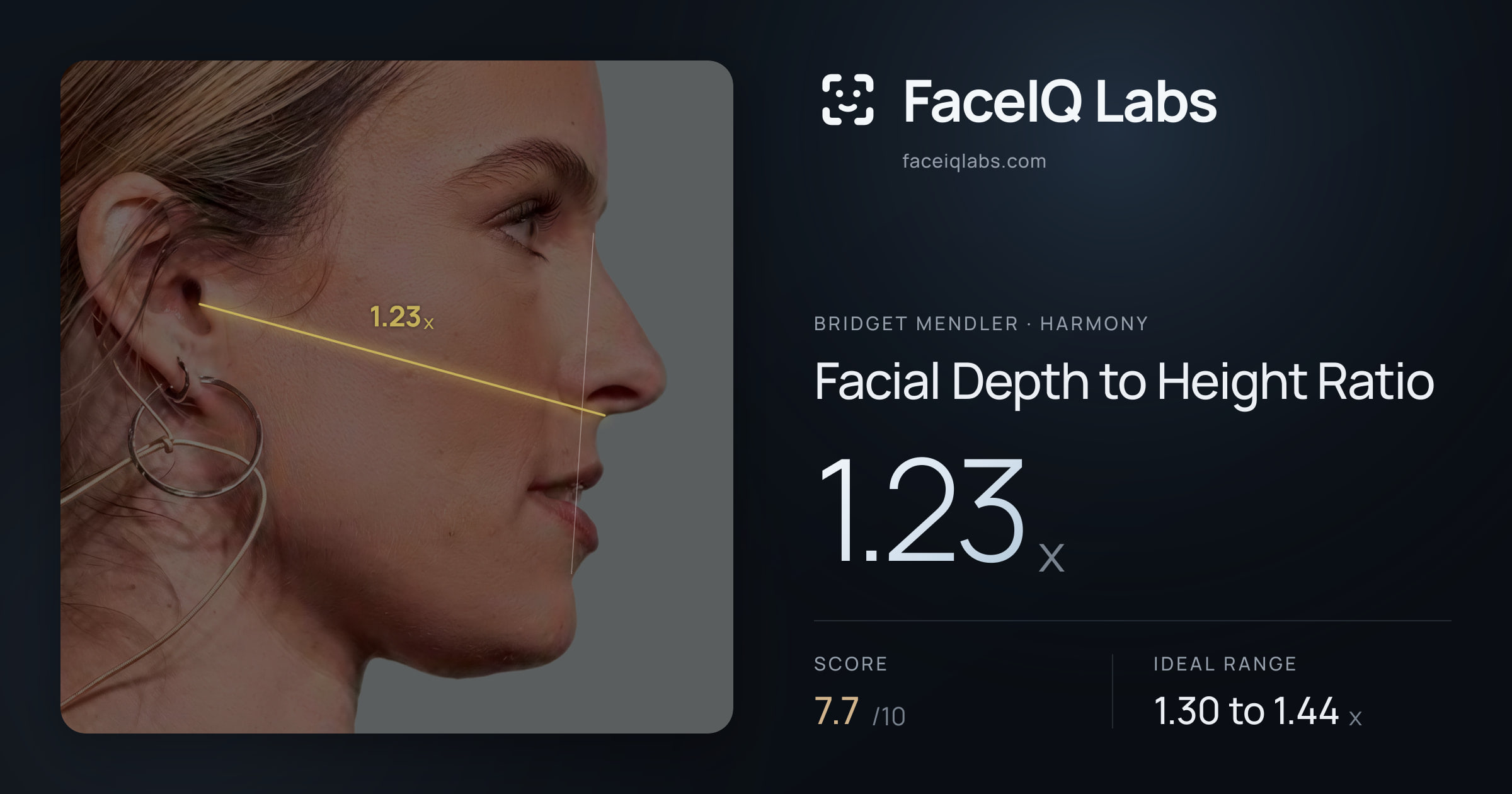 Bridget Mendler Facial Depth to Height Ratio: 1.23x, drawn on the photo