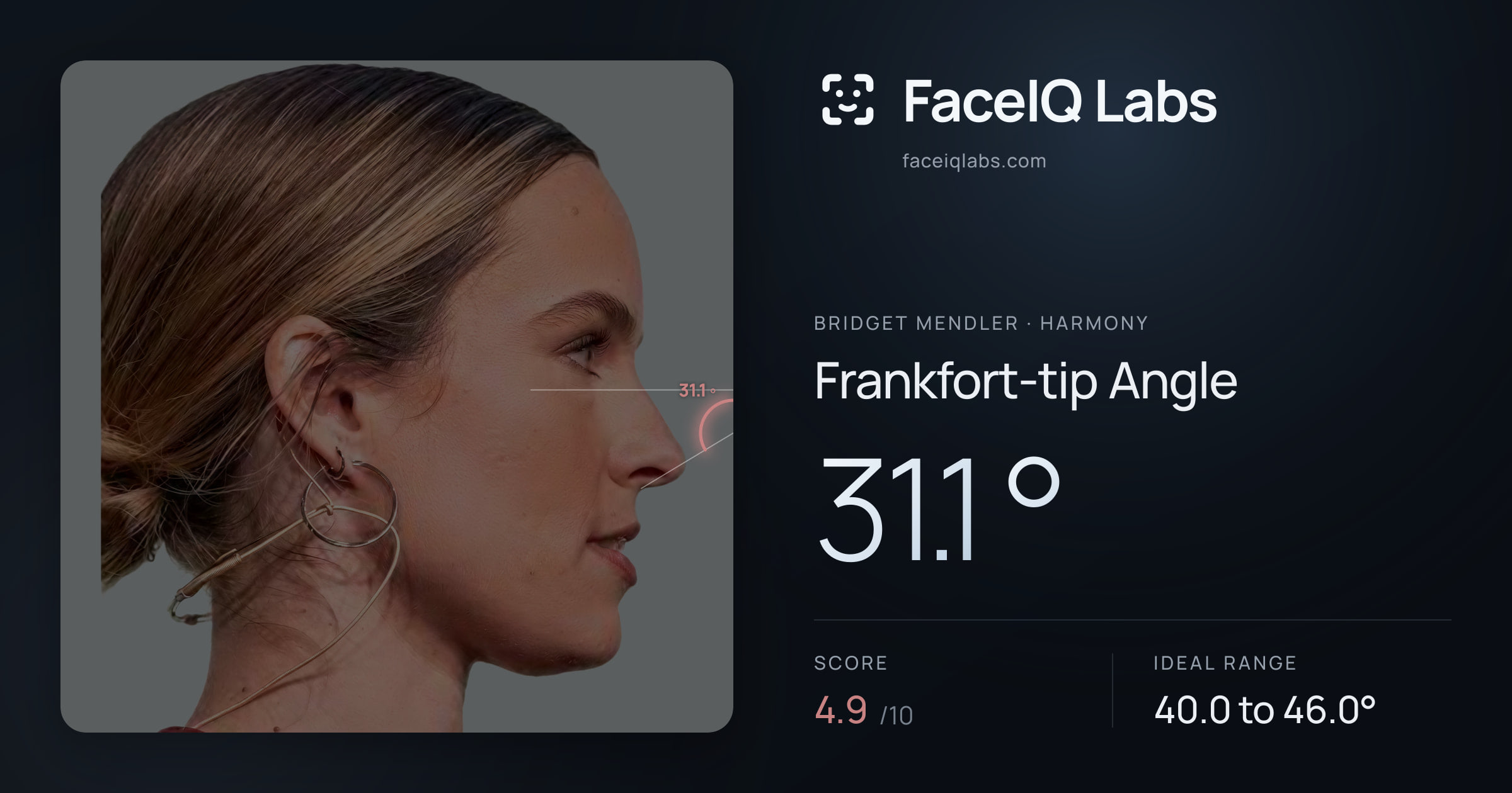 Bridget Mendler Frankfort-tip Angle: 31.1°, drawn on the photo