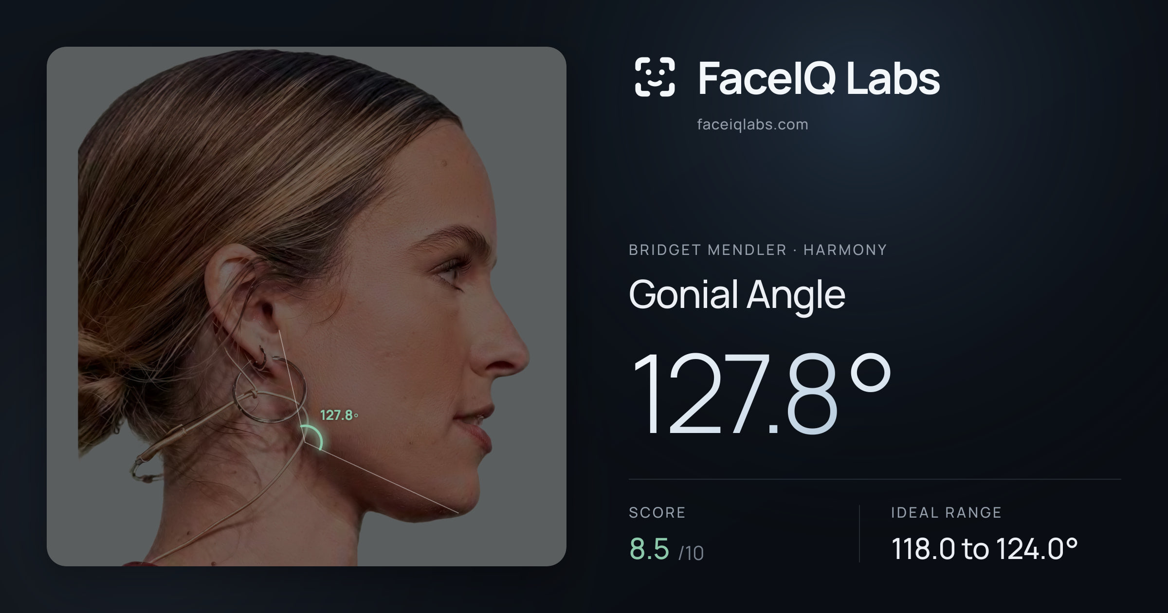 Bridget Mendler Gonial Angle: 127.8°, drawn on the photo