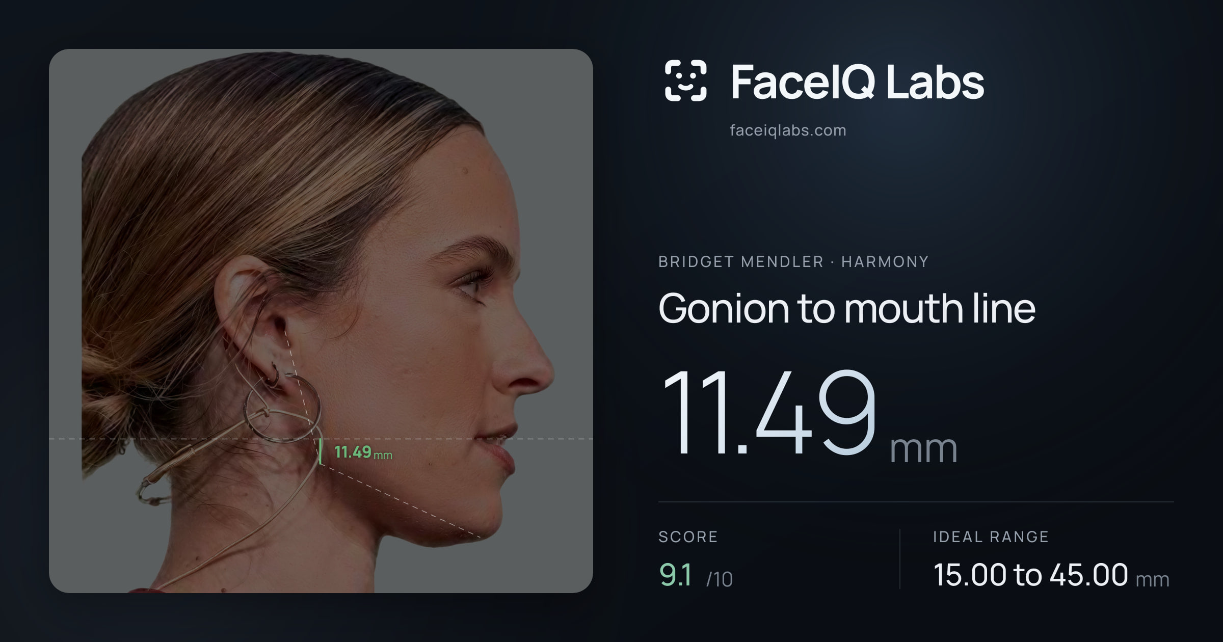 Bridget Mendler Gonion to mouth line: 11.49mm, drawn on the photo