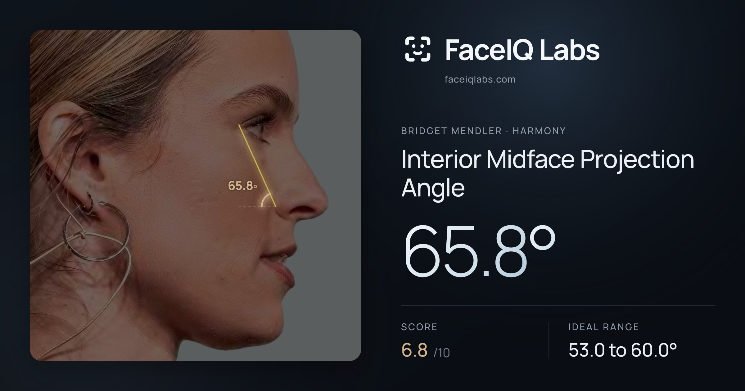 Bridget Mendler Interior Midface Projection Angle: 65.8°, drawn on the photo