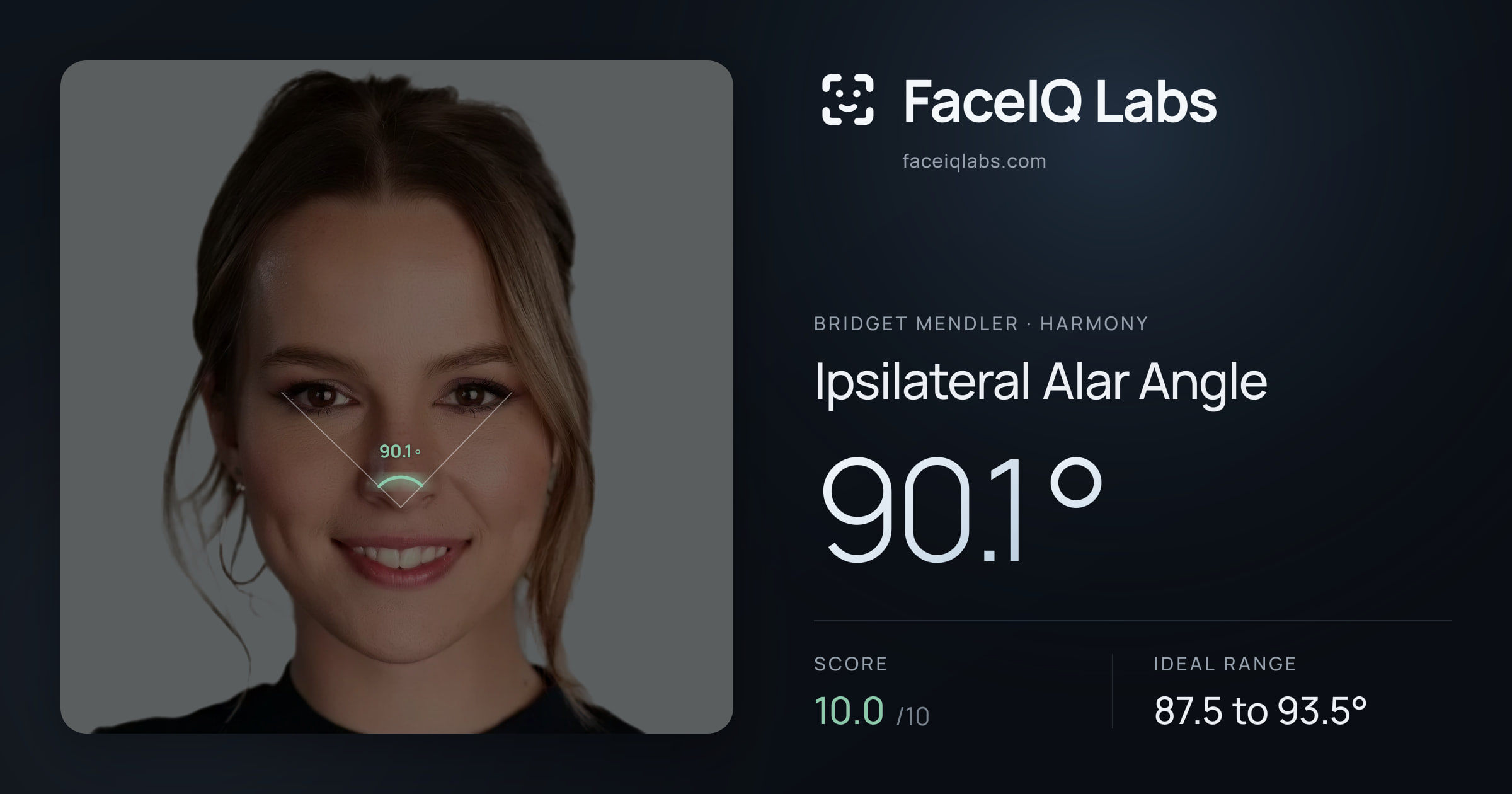Bridget Mendler Ipsilateral Alar Angle: 90.1°, drawn on the photo