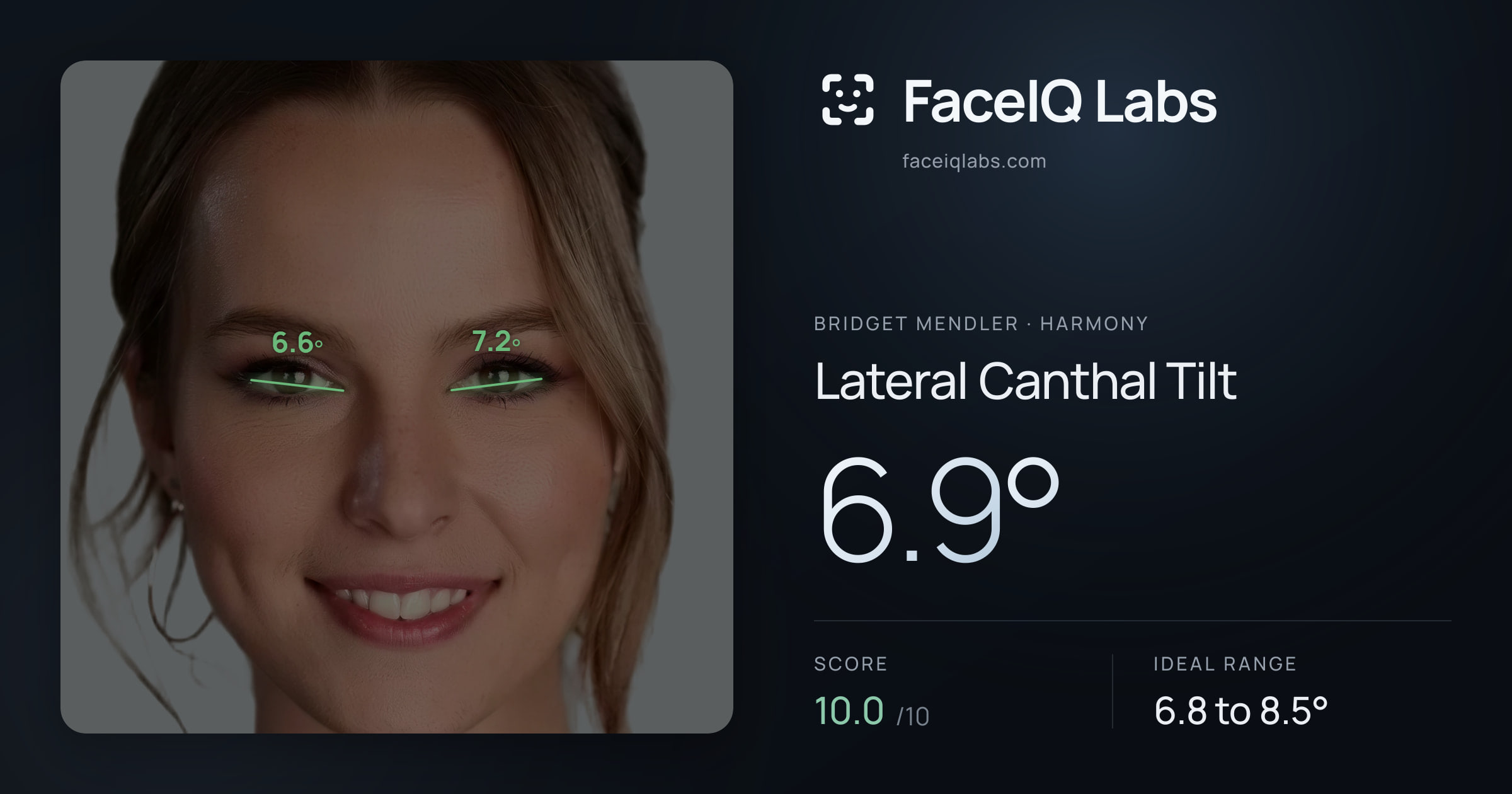 Bridget Mendler Lateral Canthal Tilt: 6.9°, drawn on the photo