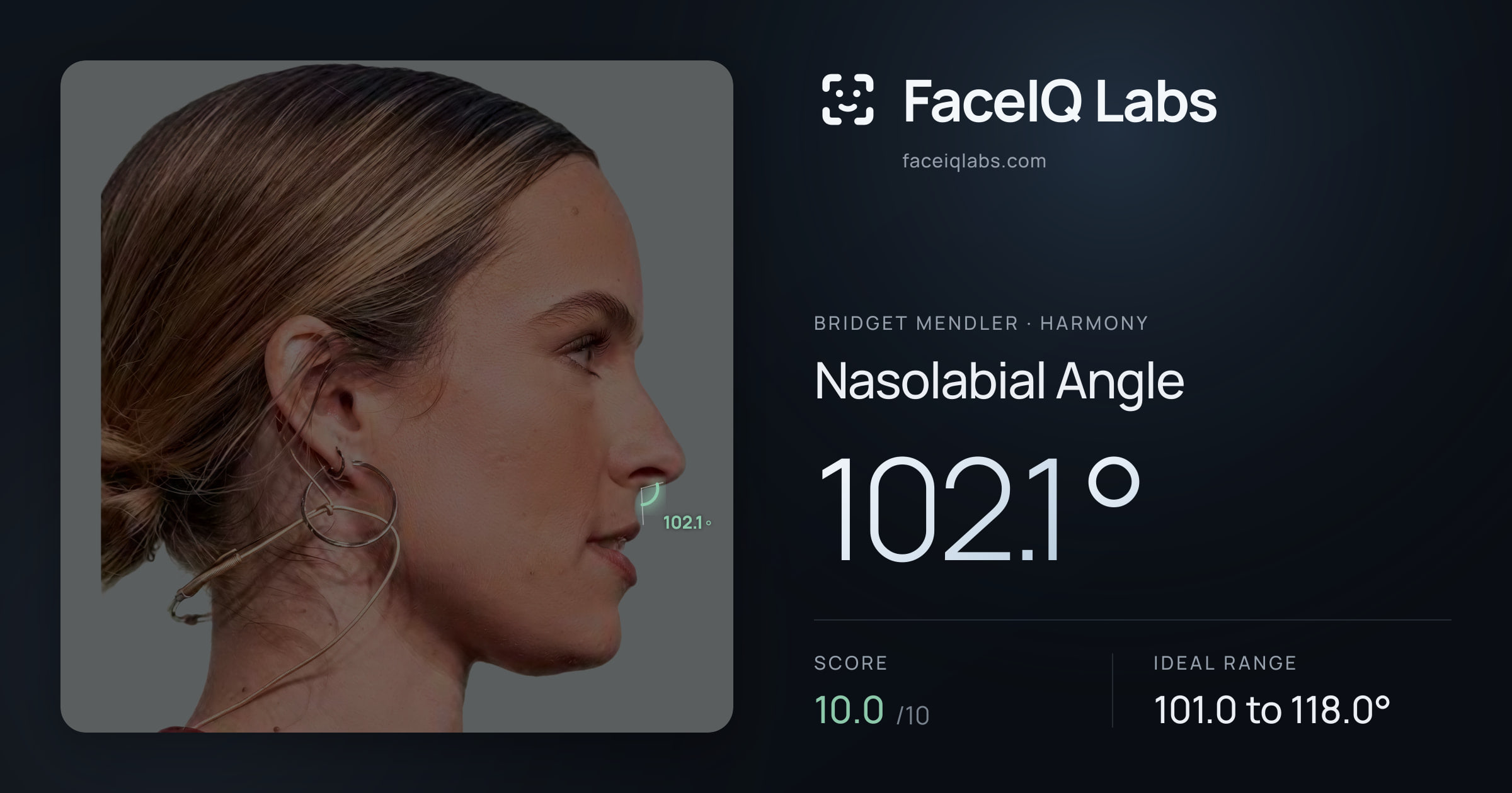 Bridget Mendler Nasolabial Angle: 102.1°, drawn on the photo