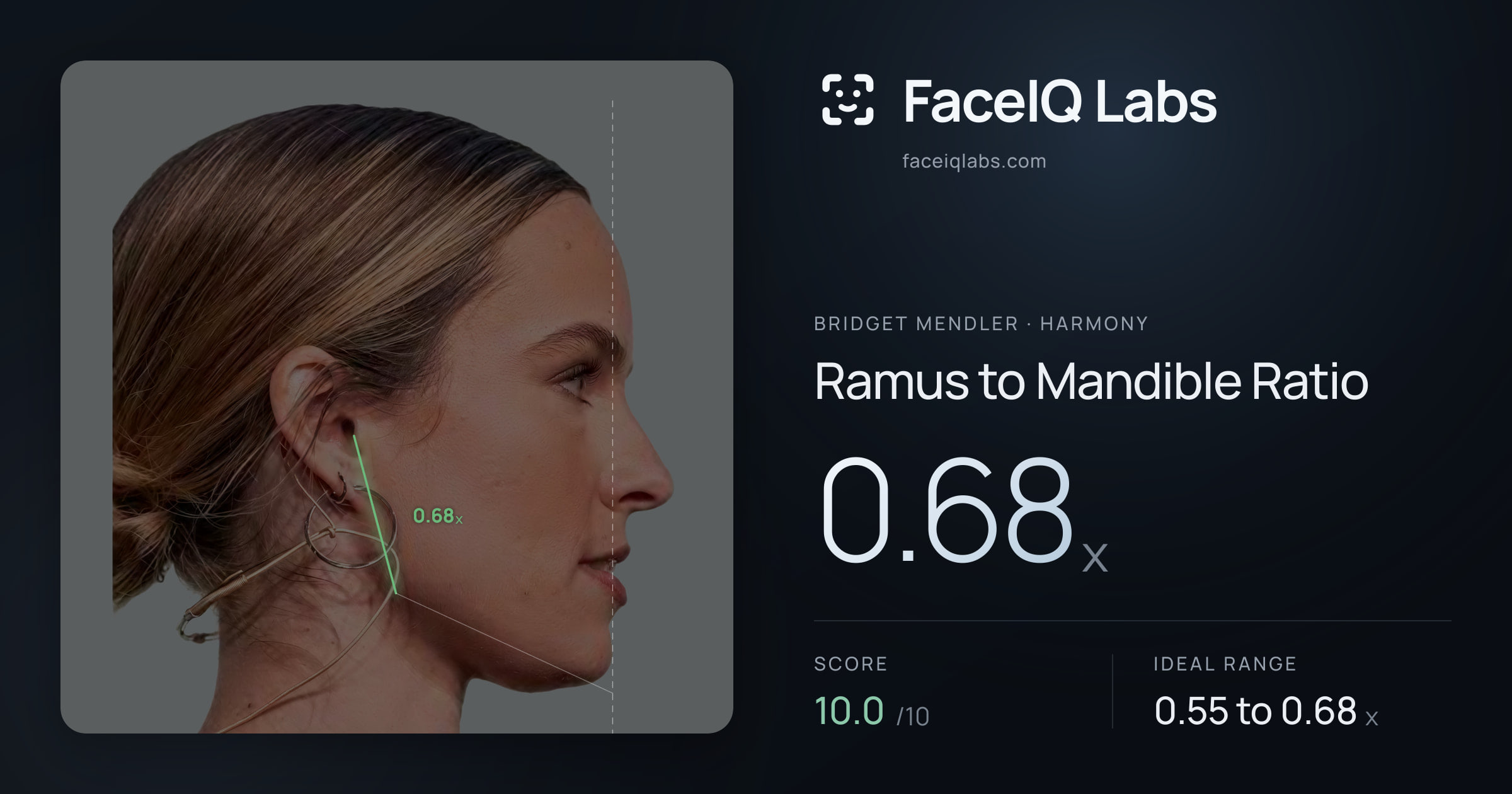 Bridget Mendler Ramus to Mandible Ratio: 0.68x, drawn on the photo