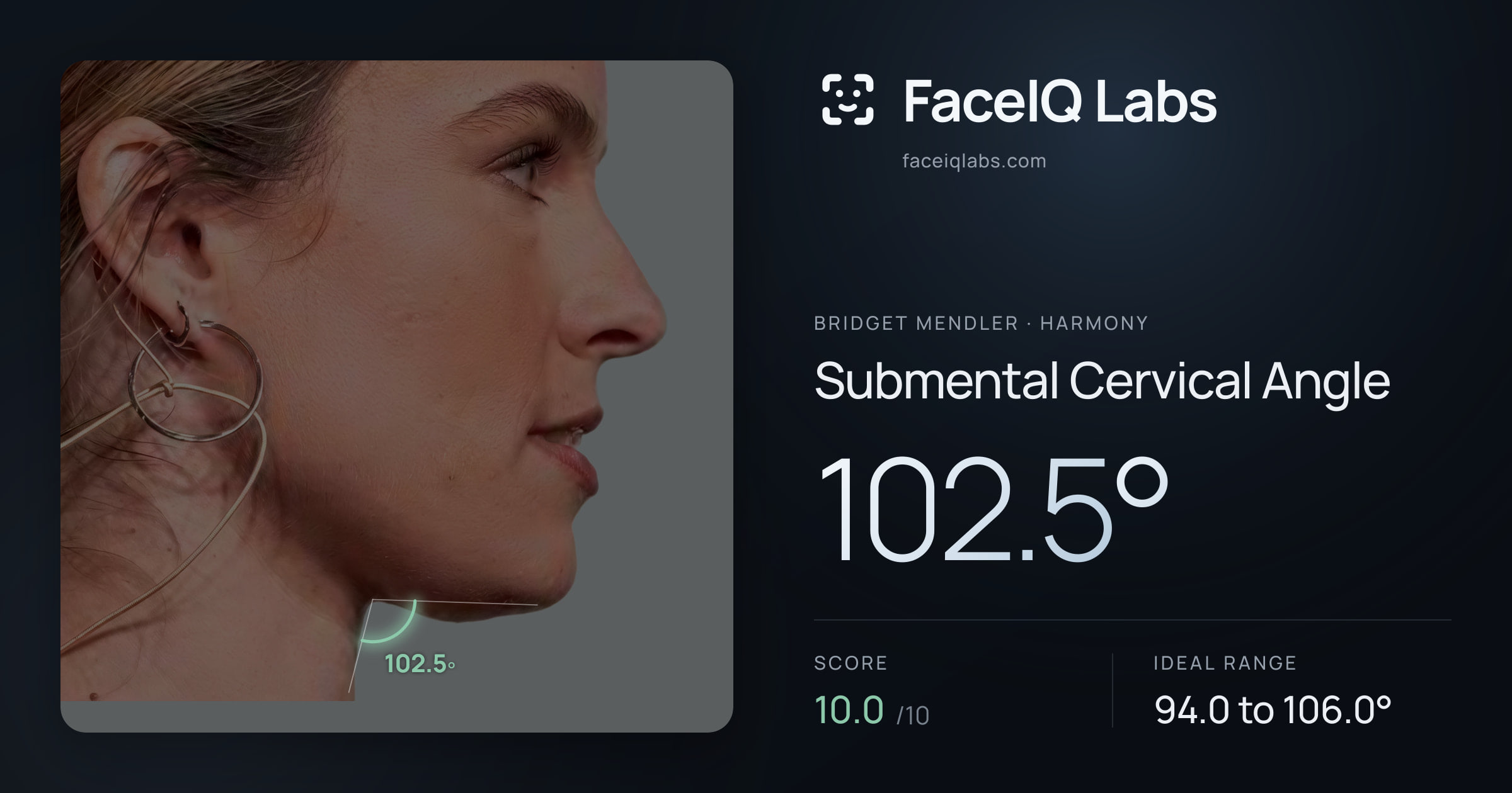 Bridget Mendler Submental Cervical Angle: 102.5°, drawn on the photo