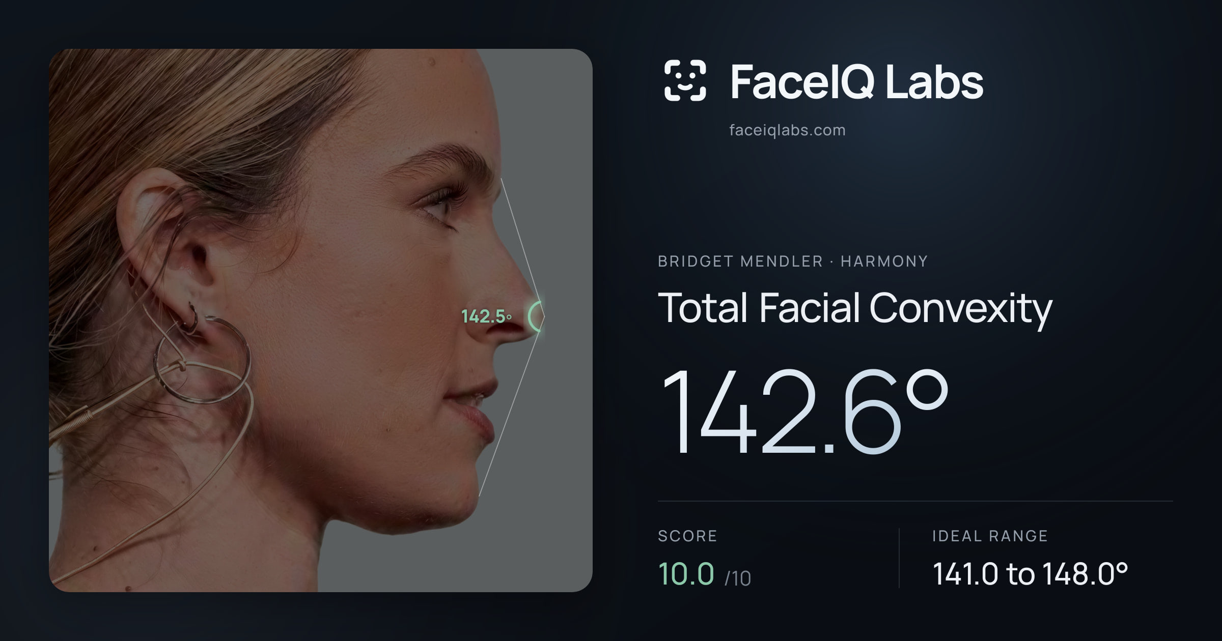 Bridget Mendler Total Facial Convexity: 142.6°, drawn on the photo