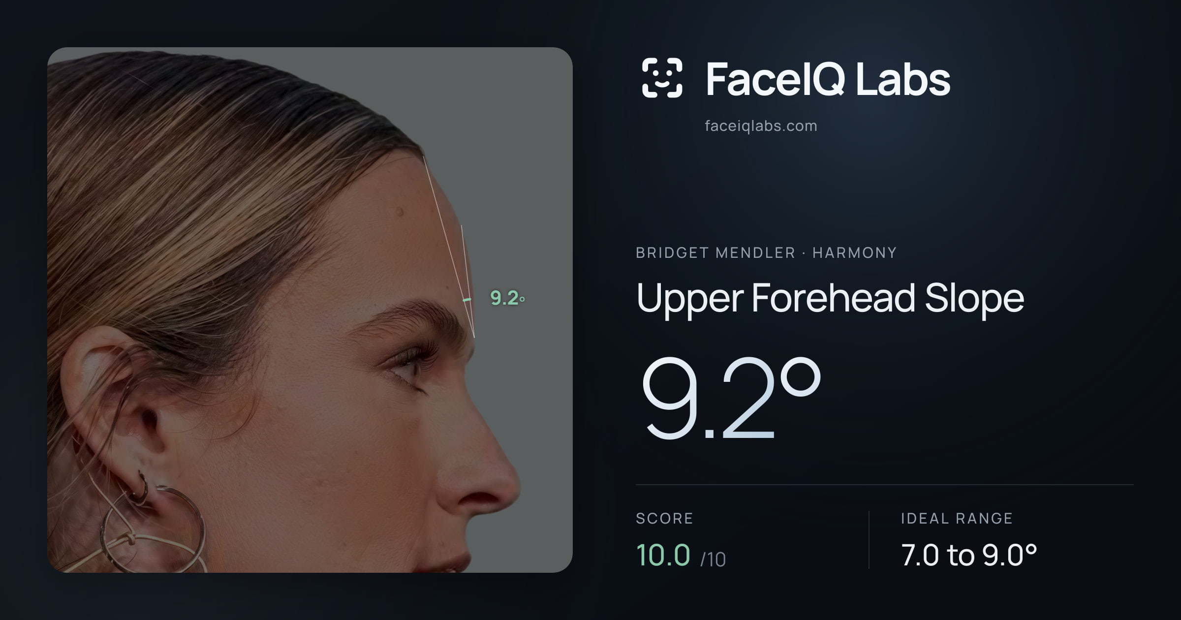 Bridget Mendler Upper Forehead Slope: 9.2°, drawn on the photo