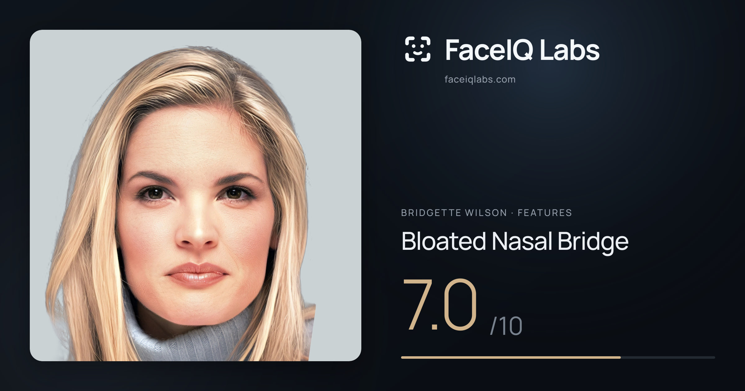Bridgette Wilson Bloated Nasal Bridge: 7.0/10, drawn on the photo
