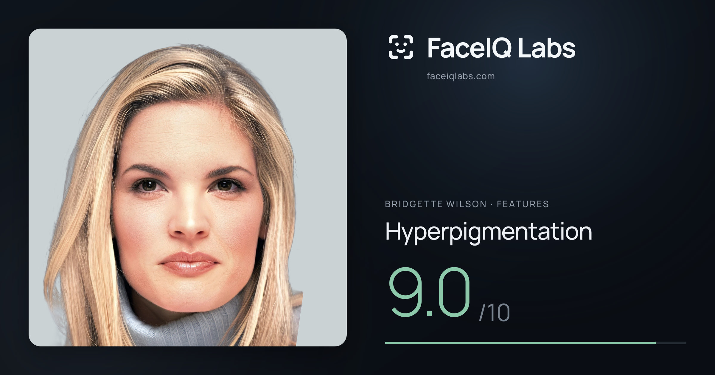 Bridgette Wilson Hyperpigmentation: 9.0/10, drawn on the photo