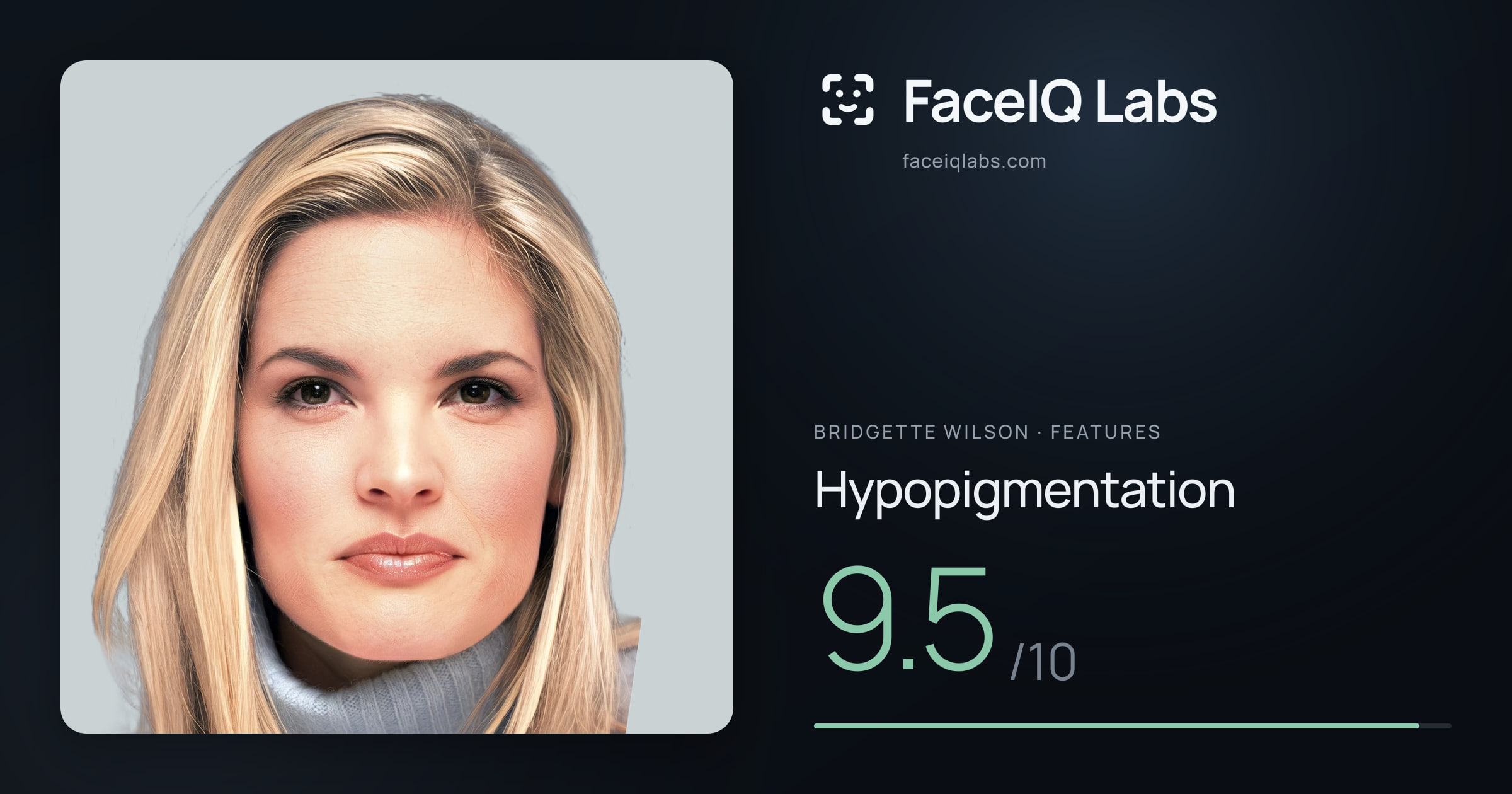 Bridgette Wilson Hypopigmentation: 9.5/10, drawn on the photo