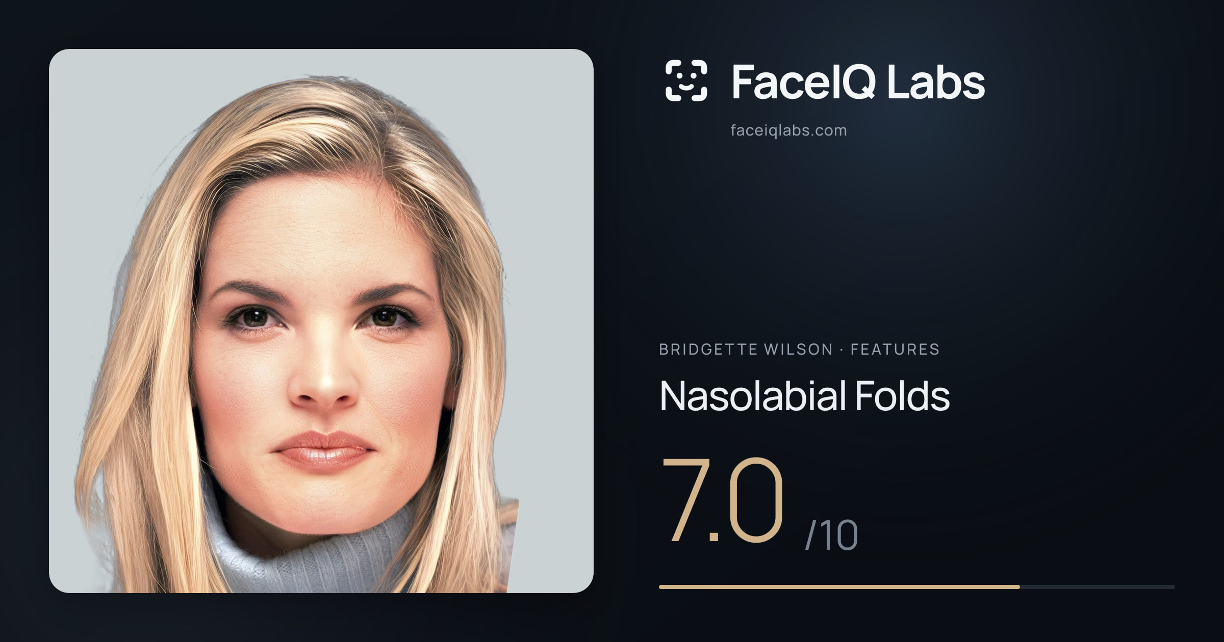 Bridgette Wilson Nasolabial Folds: 7.0/10, drawn on the photo