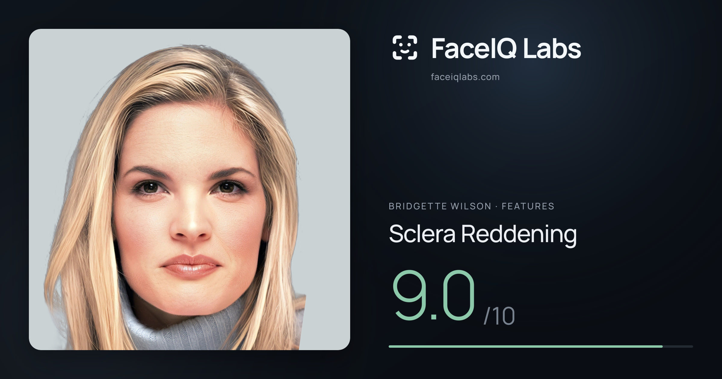 Bridgette Wilson Sclera Reddening: 9.0/10, drawn on the photo