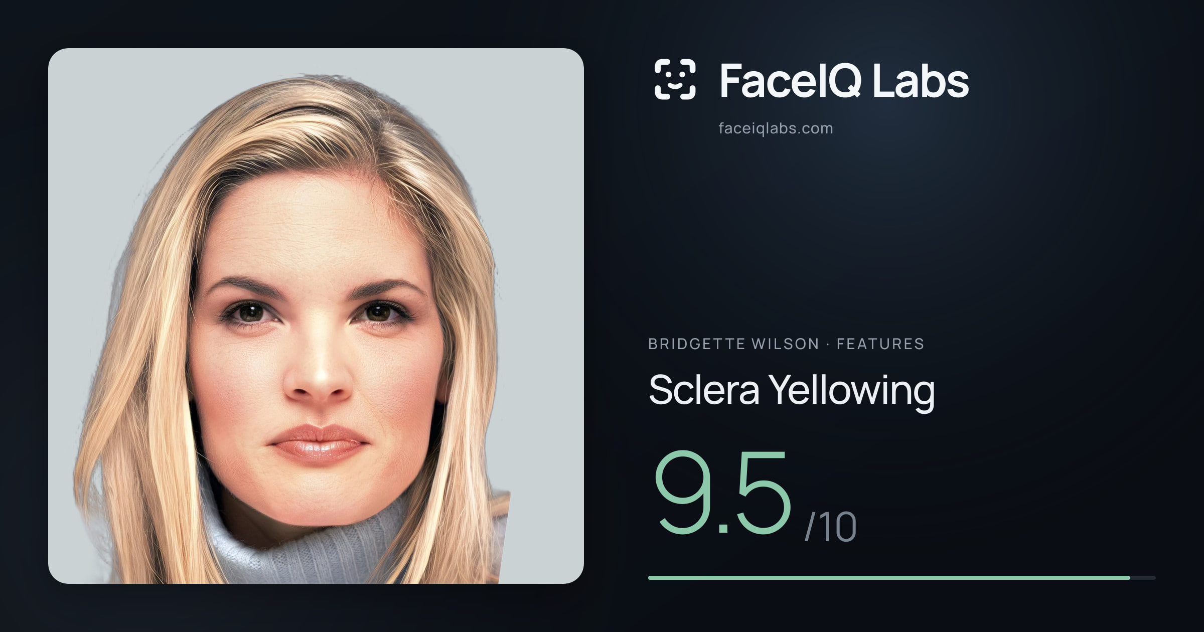 Bridgette Wilson Sclera Yellowing: 9.5/10, drawn on the photo
