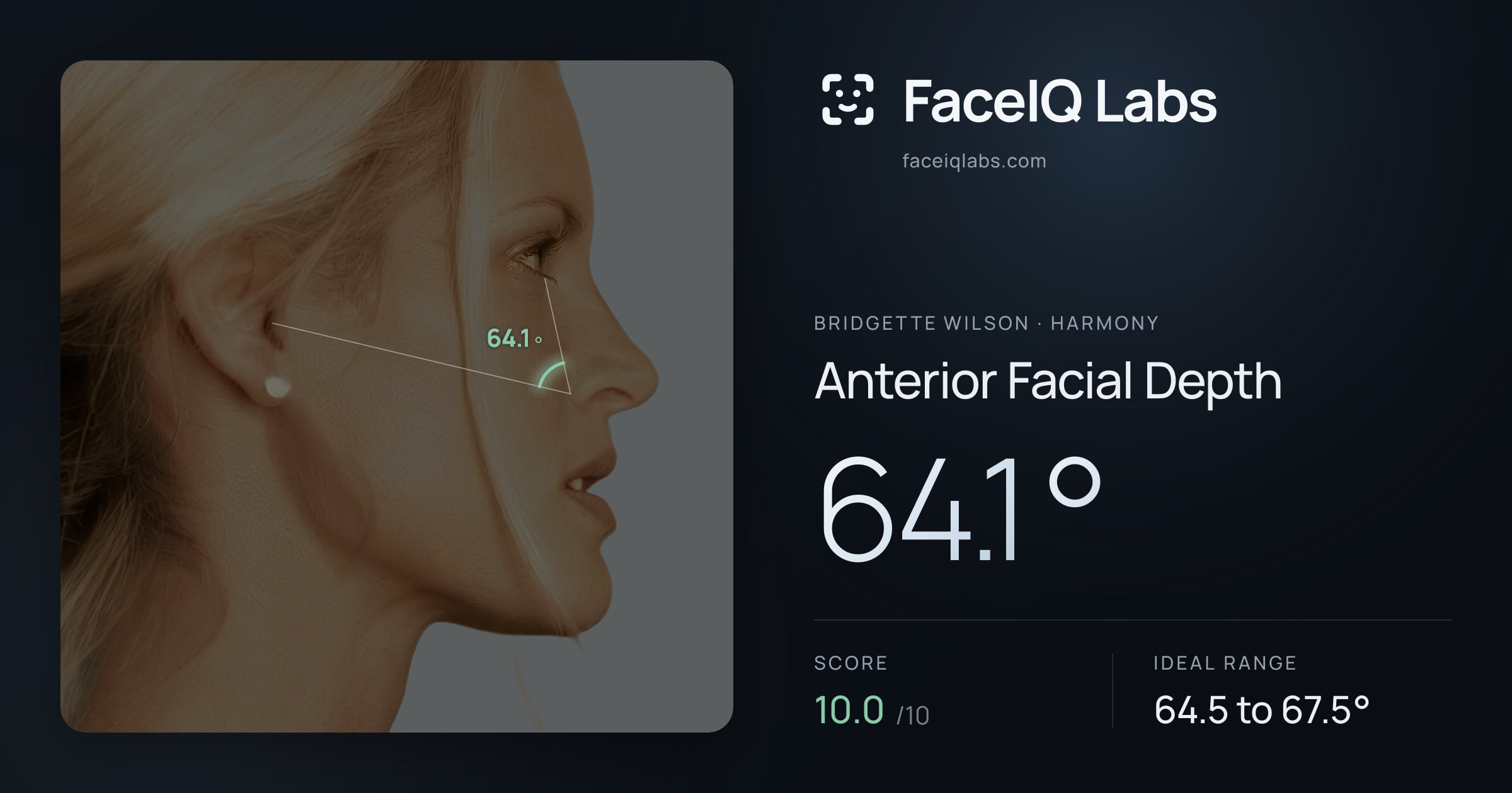 Bridgette Wilson Anterior Facial Depth: 64.1°, drawn on the photo