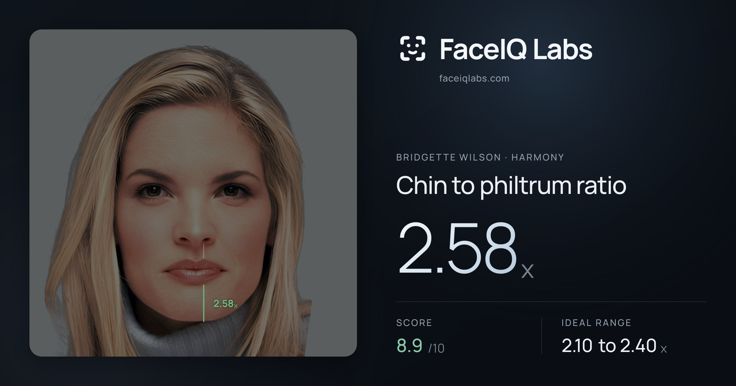 Bridgette Wilson Chin to philtrum ratio: 2.58x, drawn on the photo