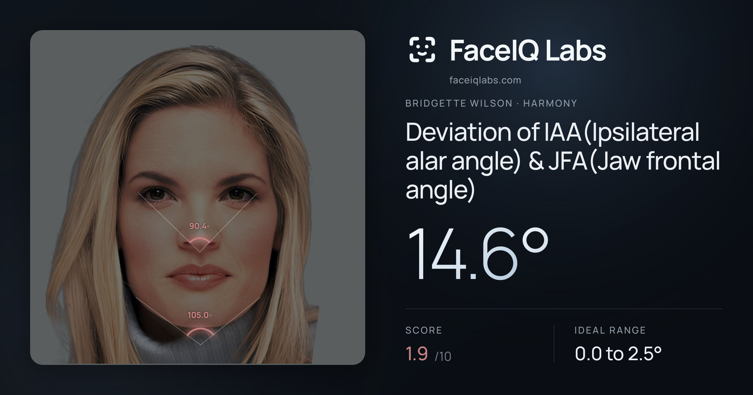 Bridgette Wilson Deviation of IAA(Ipsilateral alar angle) & JFA(Jaw frontal angle): 14.6°, drawn on the photo
