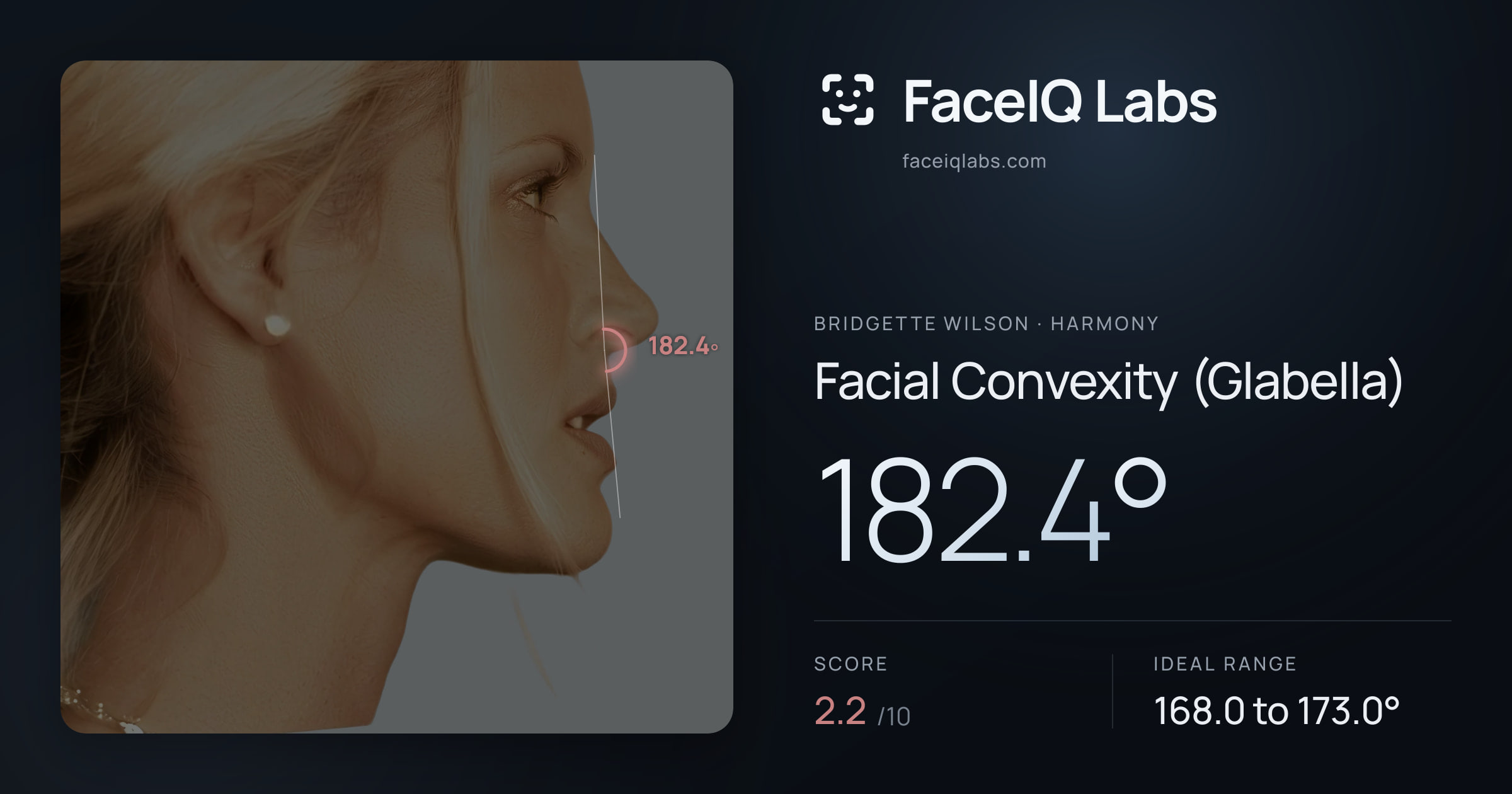 Bridgette Wilson Facial Convexity (Glabella): 182.4°, drawn on the photo