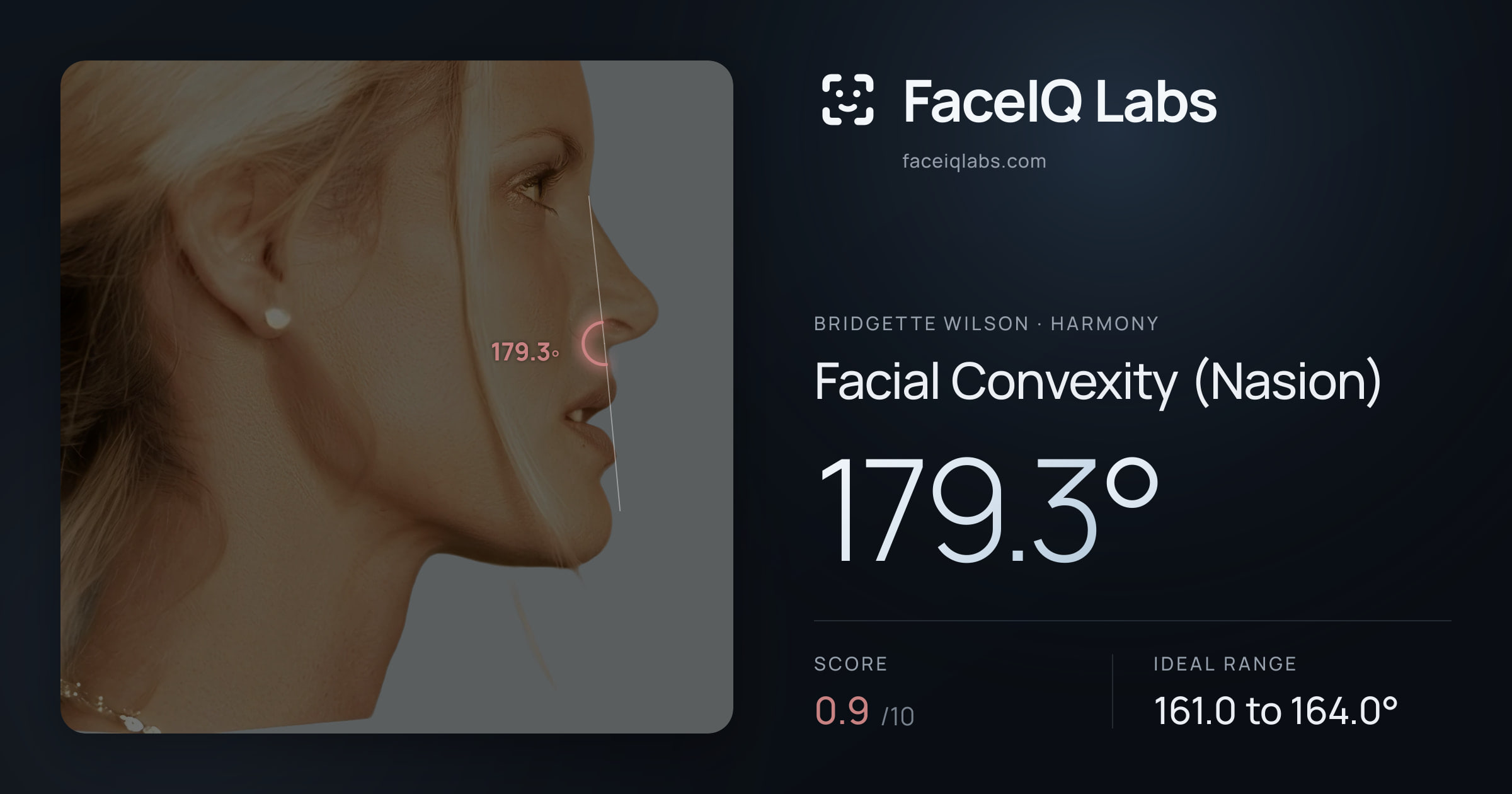 Bridgette Wilson Facial Convexity (Nasion): 179.3°, drawn on the photo