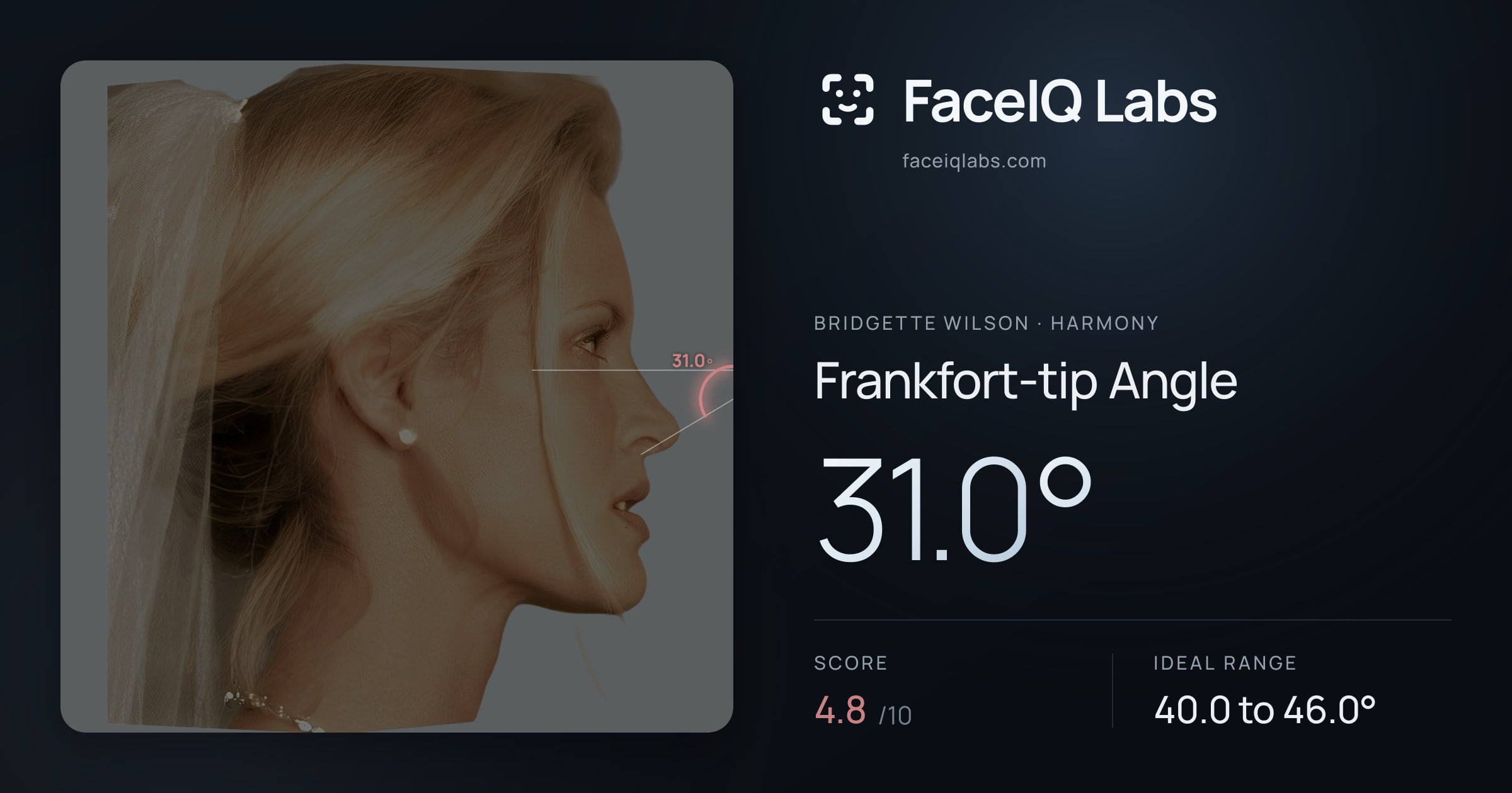 Bridgette Wilson Frankfort-tip Angle: 31.0°, drawn on the photo