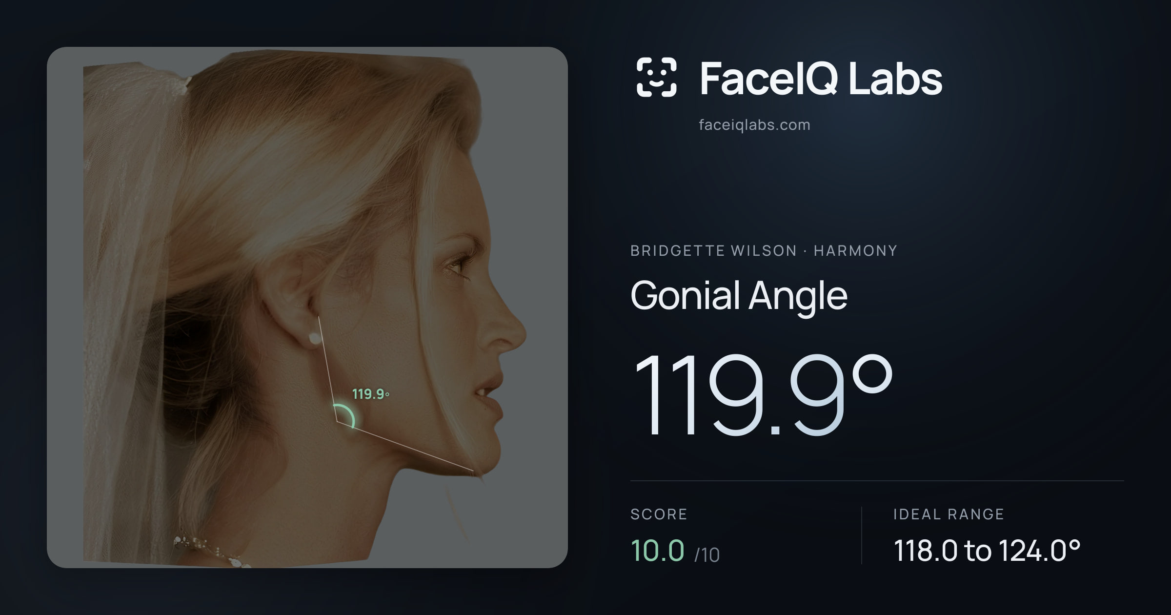 Bridgette Wilson Gonial Angle: 119.9°, drawn on the photo