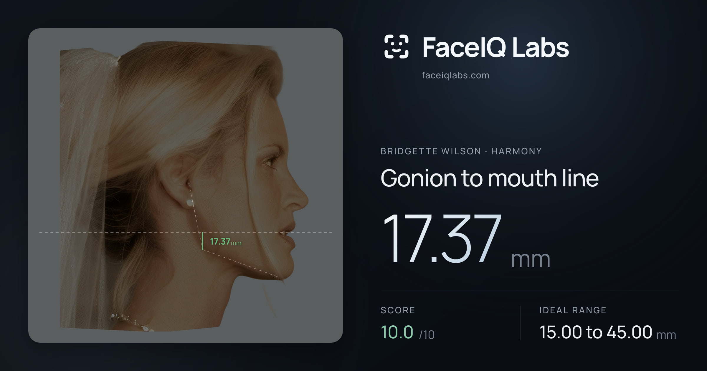 Bridgette Wilson Gonion to mouth line: 17.37mm, drawn on the photo