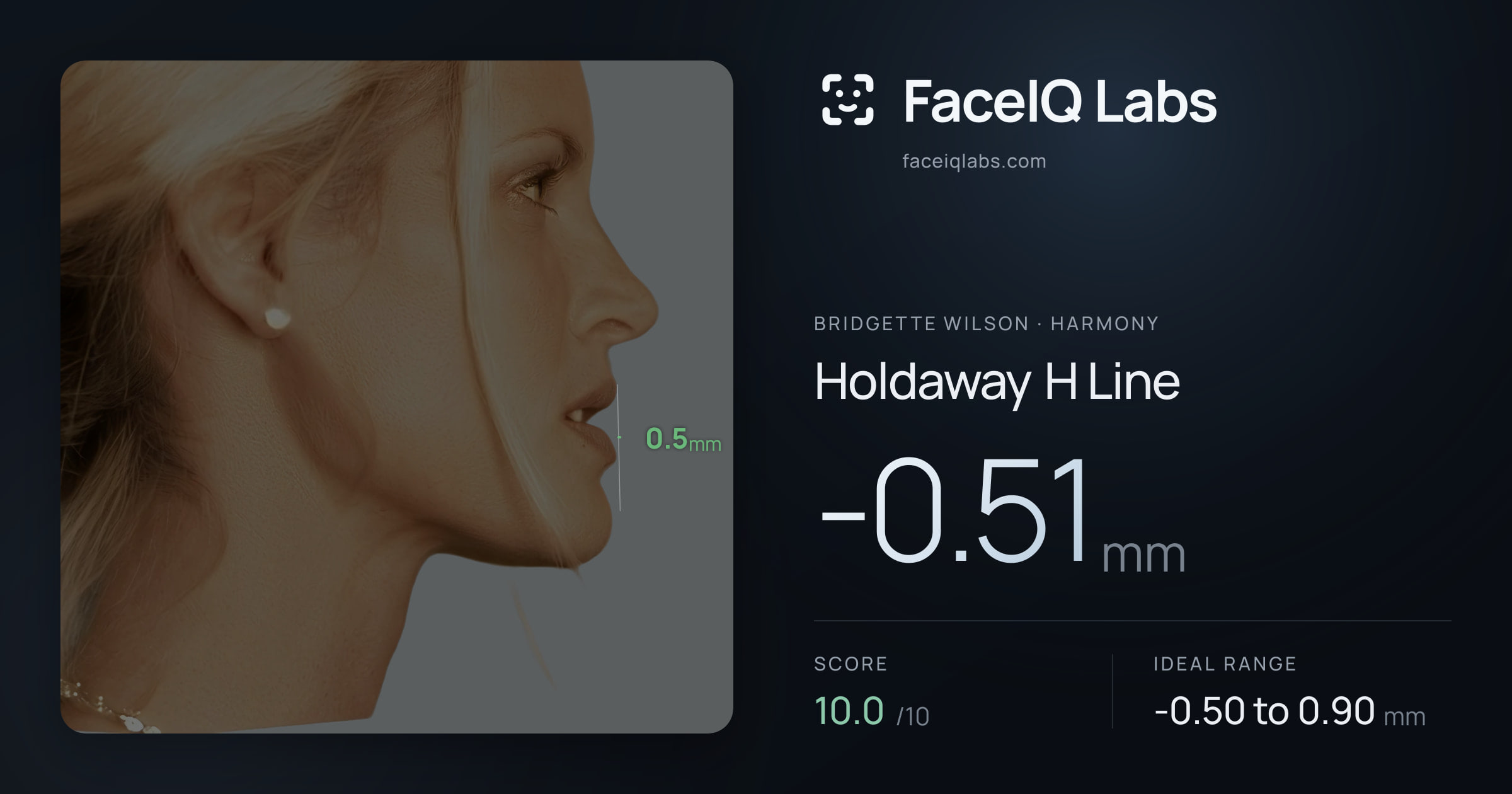 Bridgette Wilson Holdaway H Line: -0.51mm, drawn on the photo