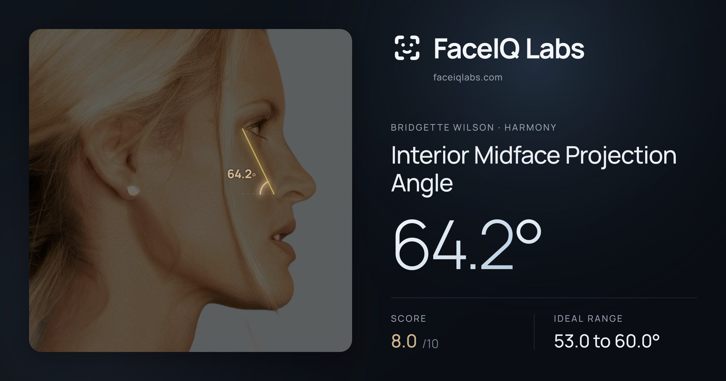 Bridgette Wilson Interior Midface Projection Angle: 64.2°, drawn on the photo