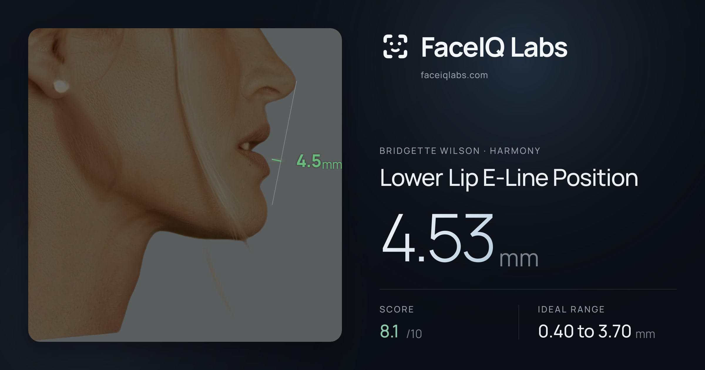 Bridgette Wilson Lower Lip E-Line Position: 4.53mm, drawn on the photo
