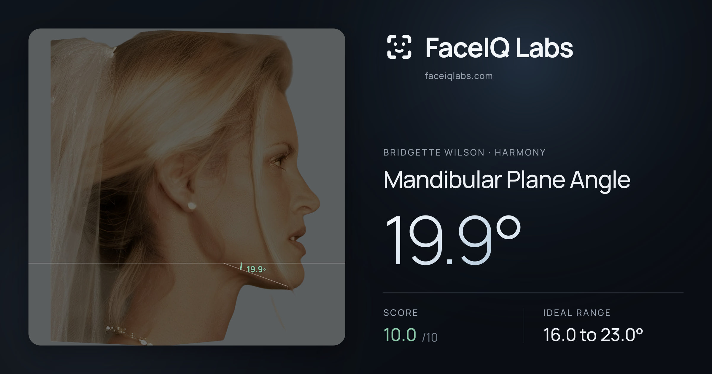 Bridgette Wilson Mandibular Plane Angle: 19.9°, drawn on the photo