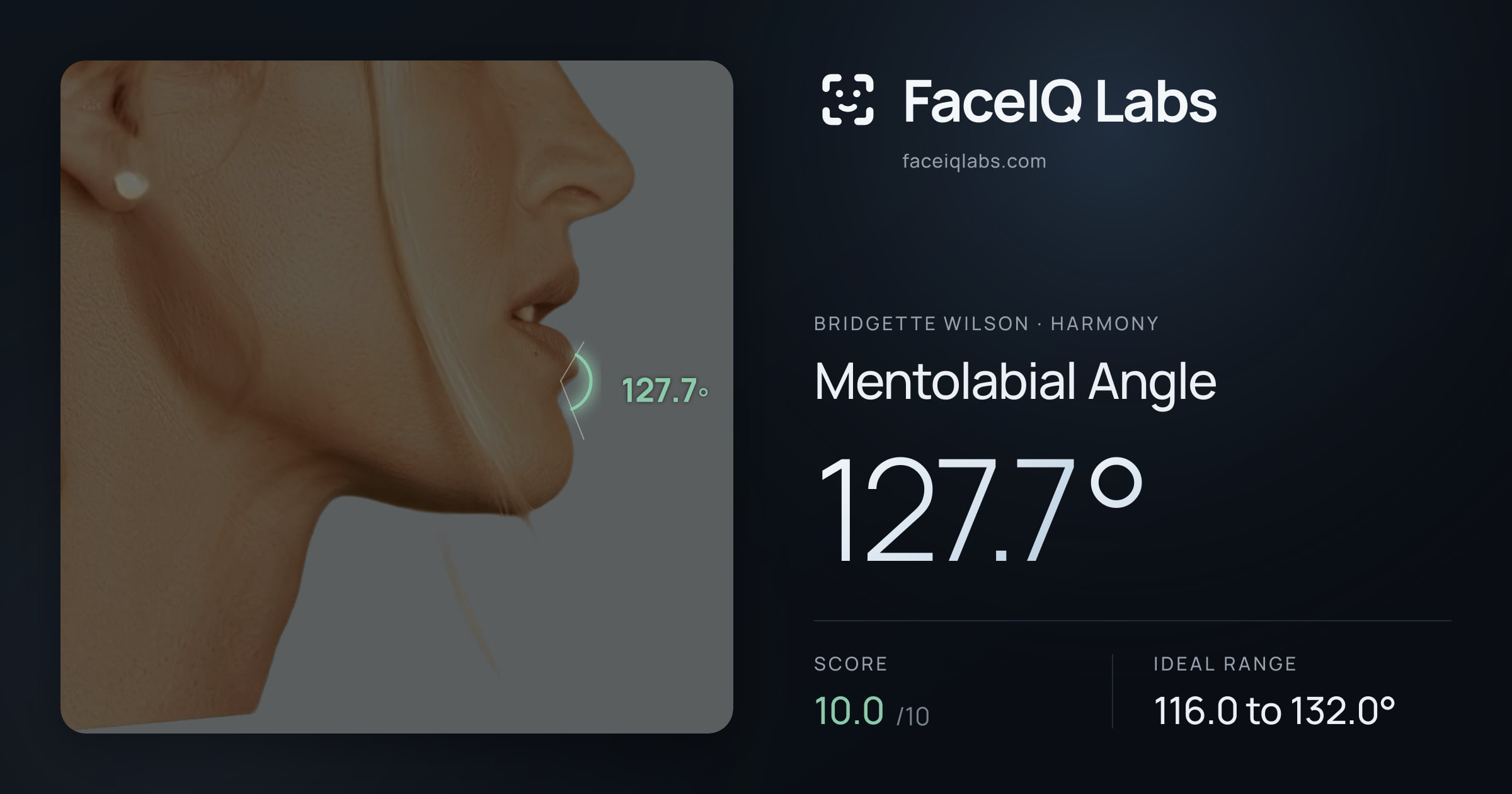 Bridgette Wilson Mentolabial Angle: 127.7°, drawn on the photo