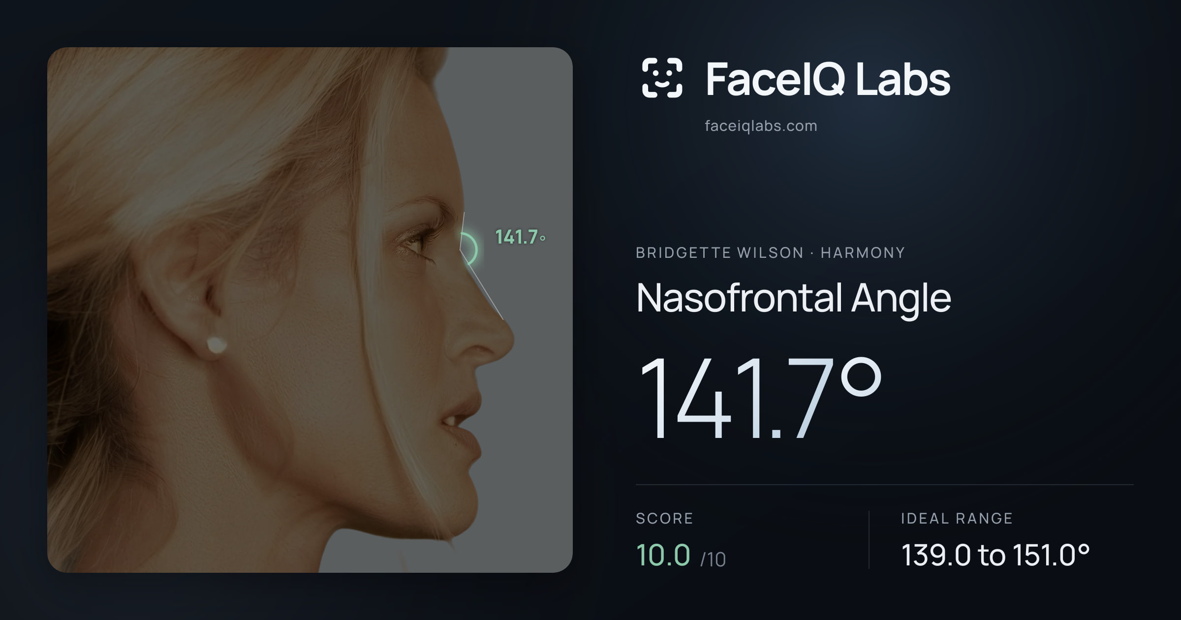 Bridgette Wilson Nasofrontal Angle: 141.7°, drawn on the photo