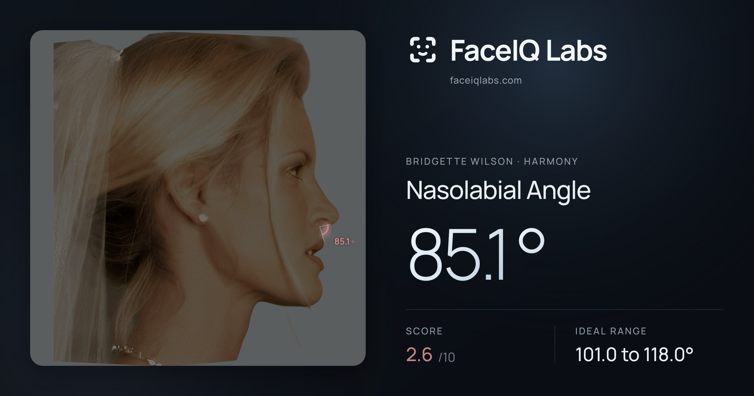 Bridgette Wilson Nasolabial Angle: 85.1°, drawn on the photo