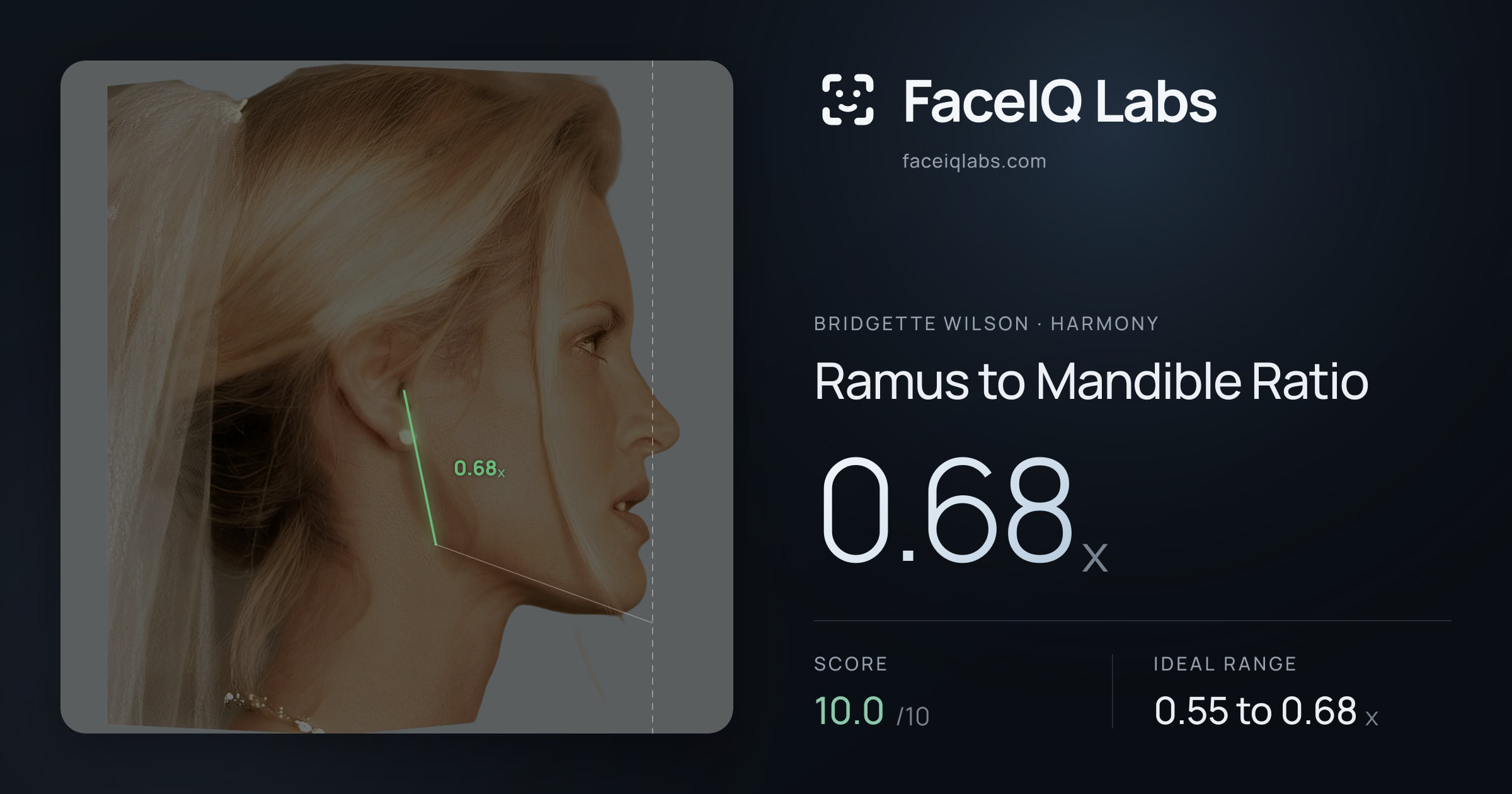 Bridgette Wilson Ramus to Mandible Ratio: 0.68x, drawn on the photo