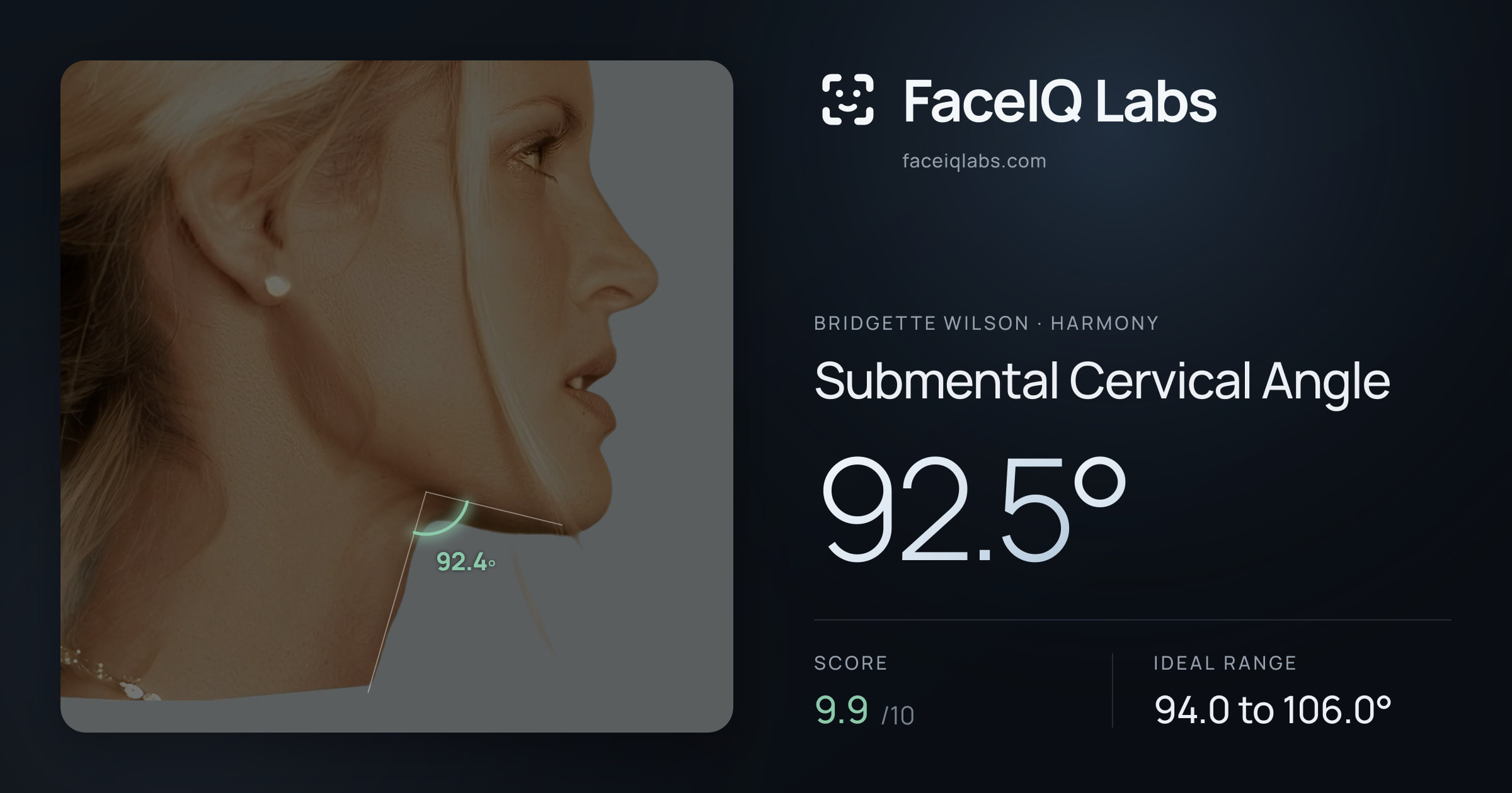 Bridgette Wilson Submental Cervical Angle: 92.5°, drawn on the photo