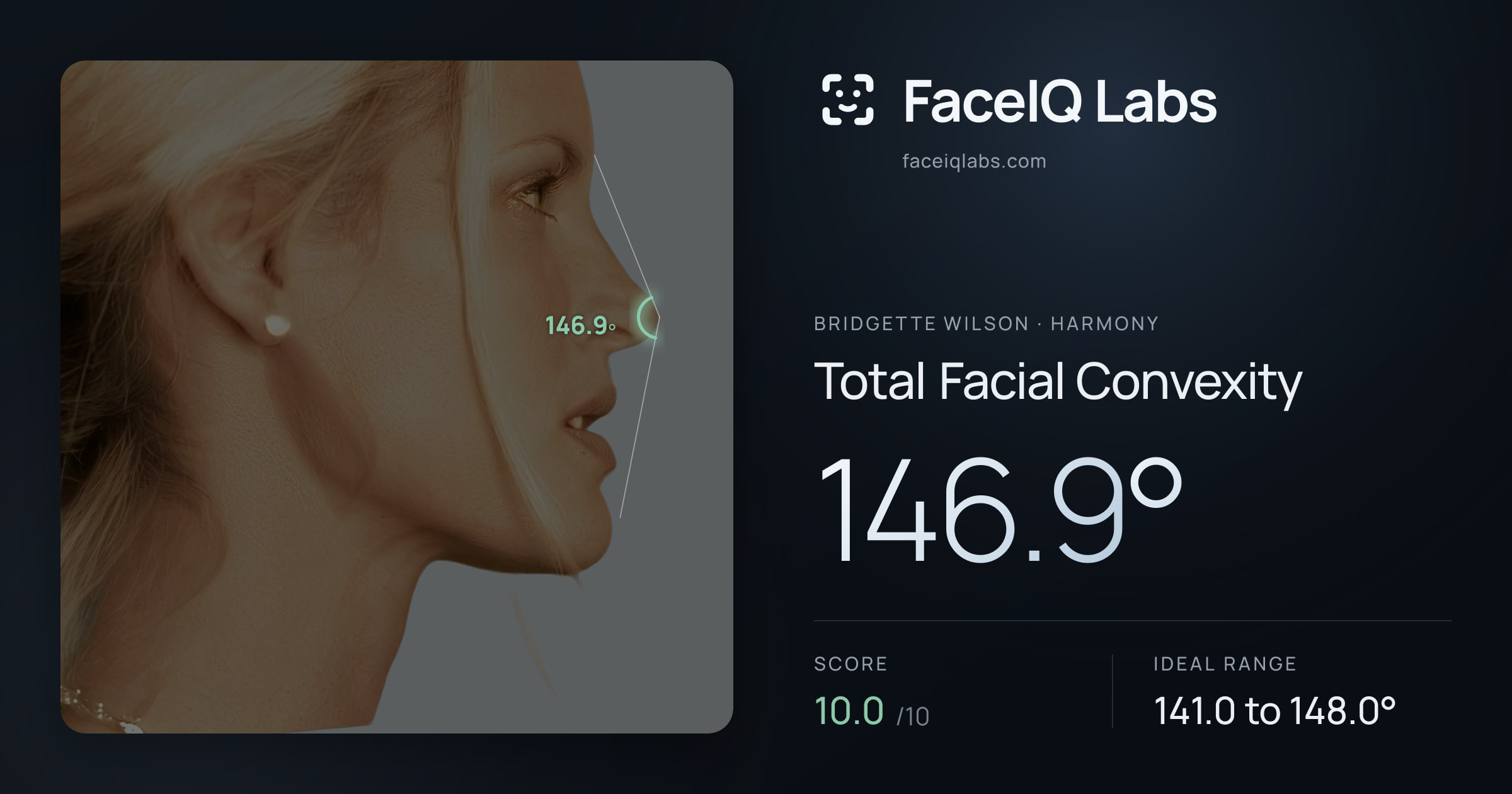 Bridgette Wilson Total Facial Convexity: 146.9°, drawn on the photo