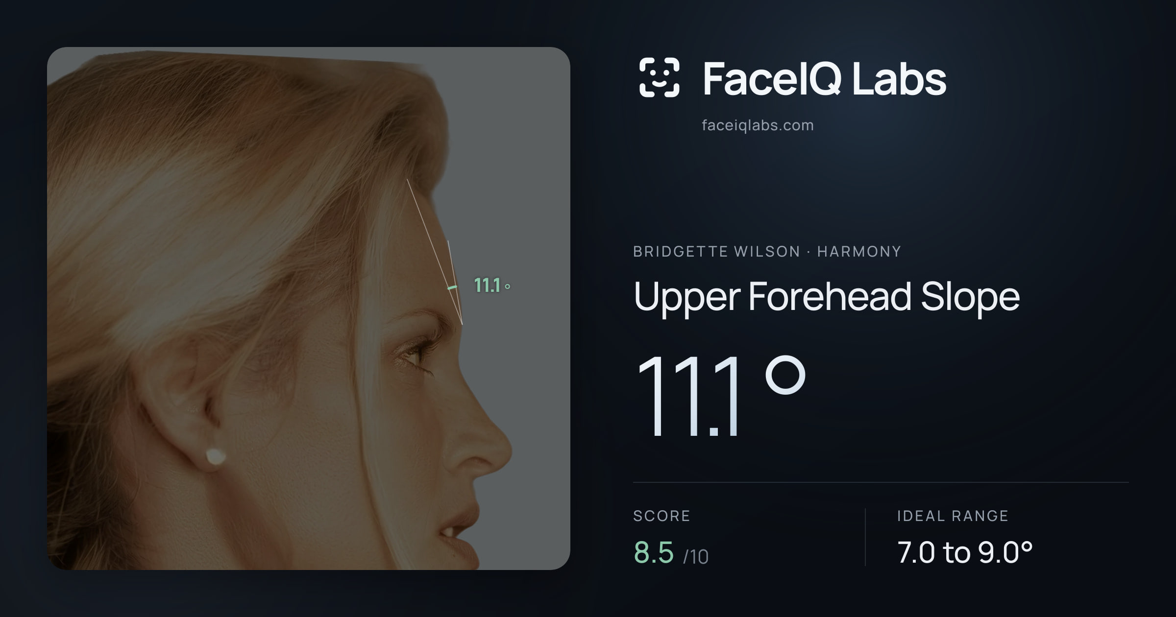 Bridgette Wilson Upper Forehead Slope: 11.1°, drawn on the photo