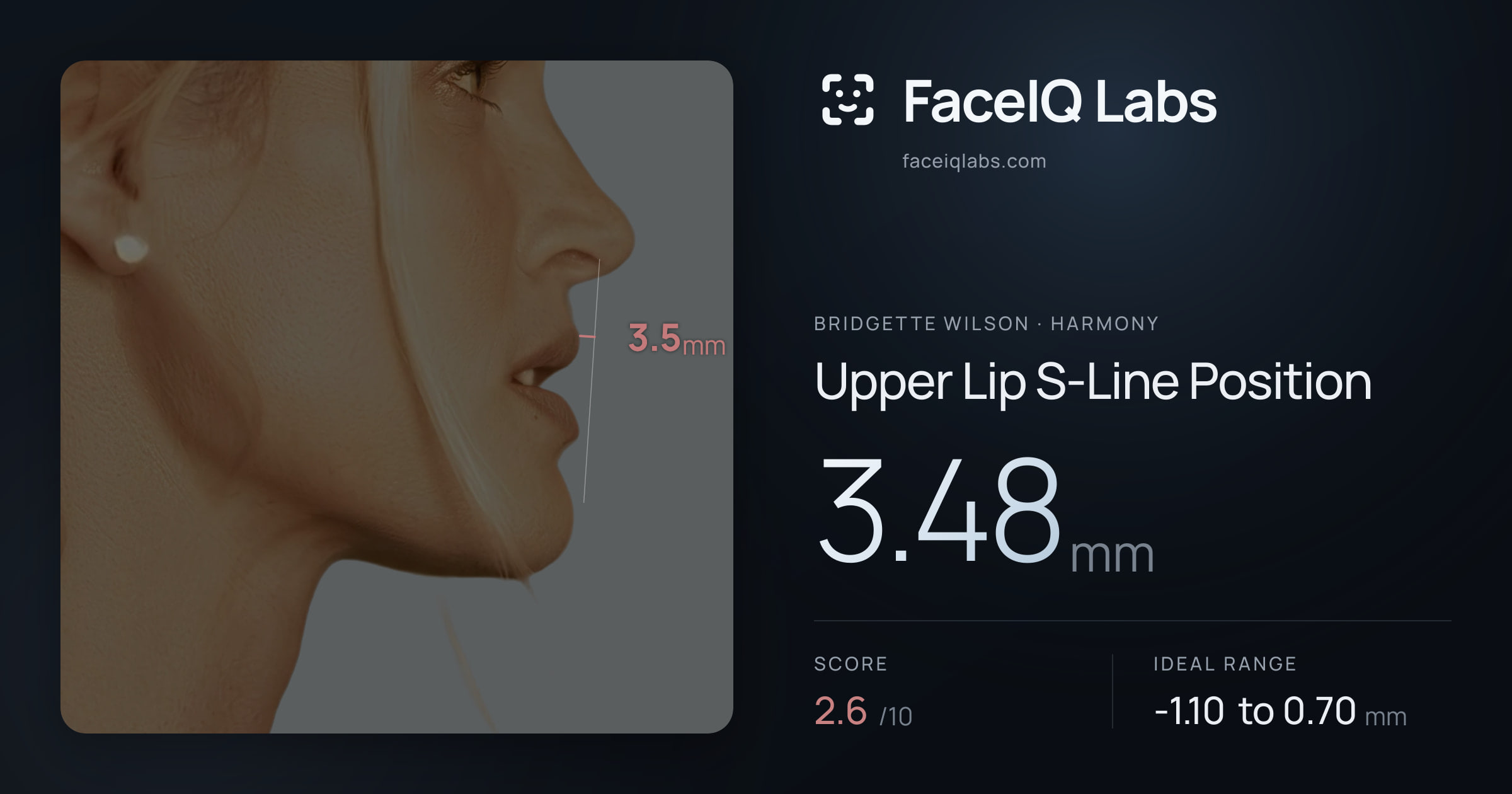 Bridgette Wilson Upper Lip S-Line Position: 3.48mm, drawn on the photo